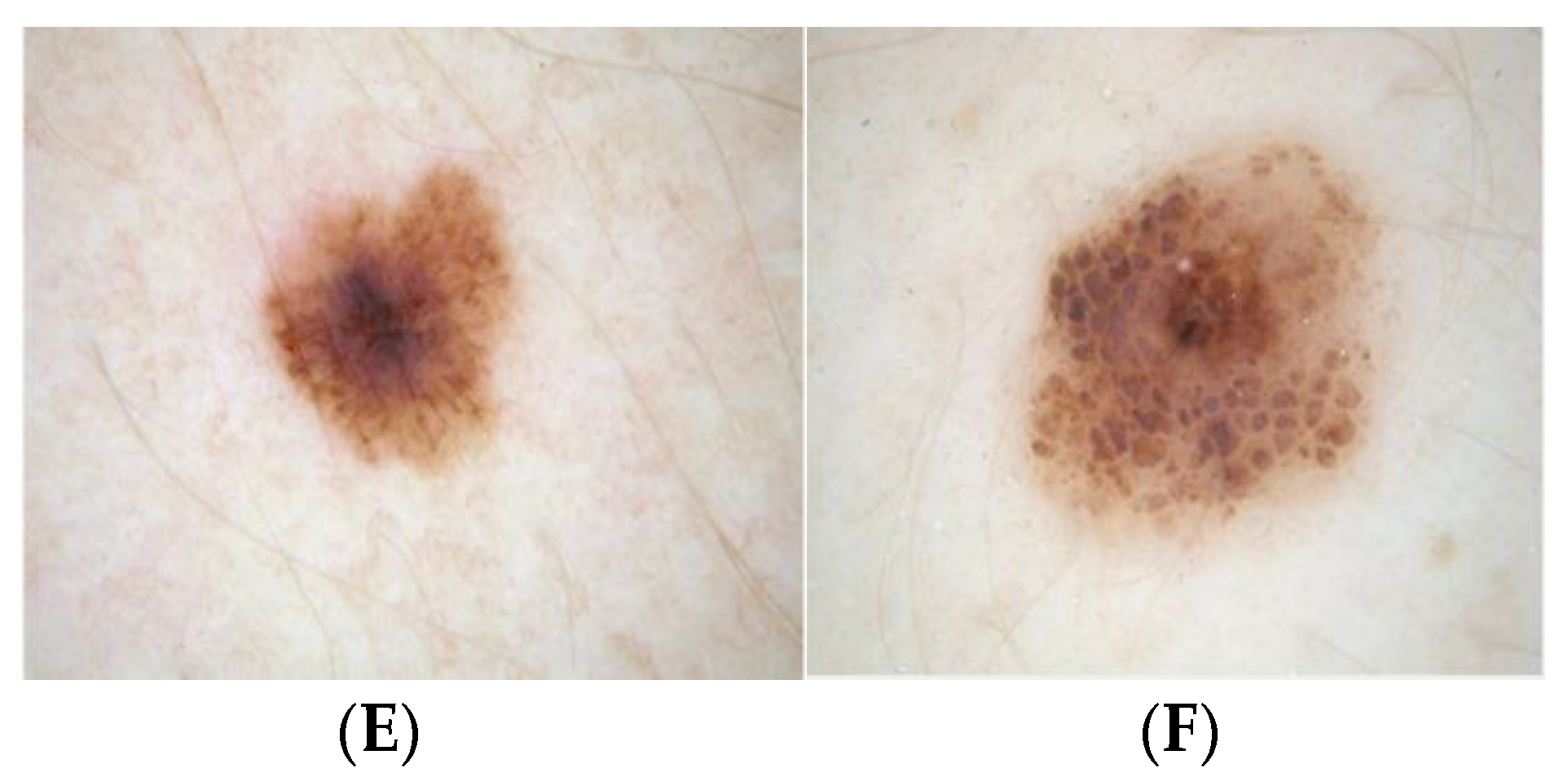 Applsci 12 04243 g003b