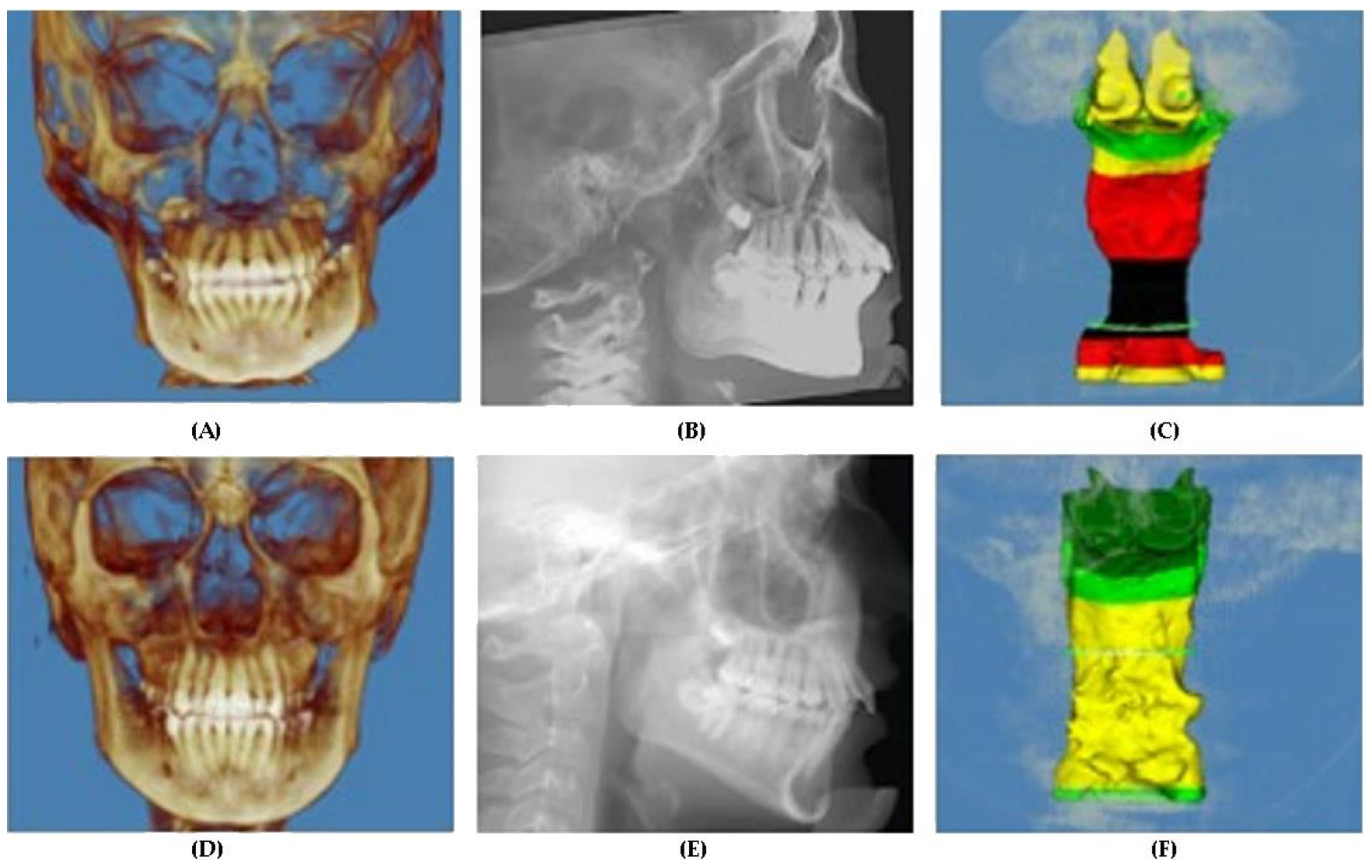 Applsci 12 04286 g004 Applsci 12 04286 g004