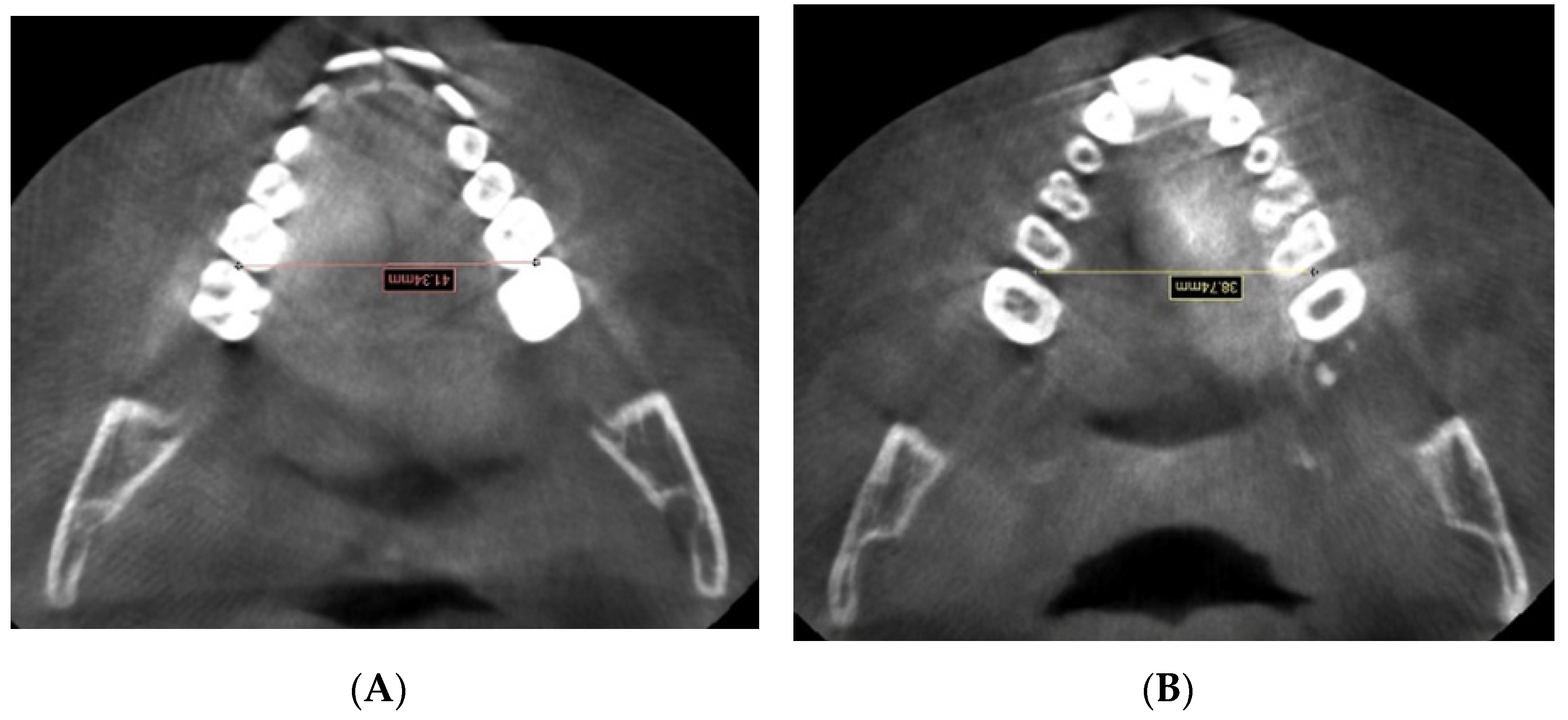 Applsci 12 04313 g003 Applsci 12 04313 g003