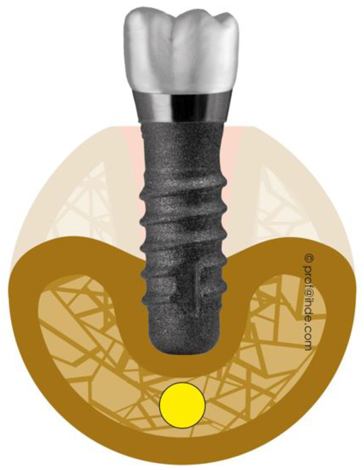 Applsci 12 04317 g004