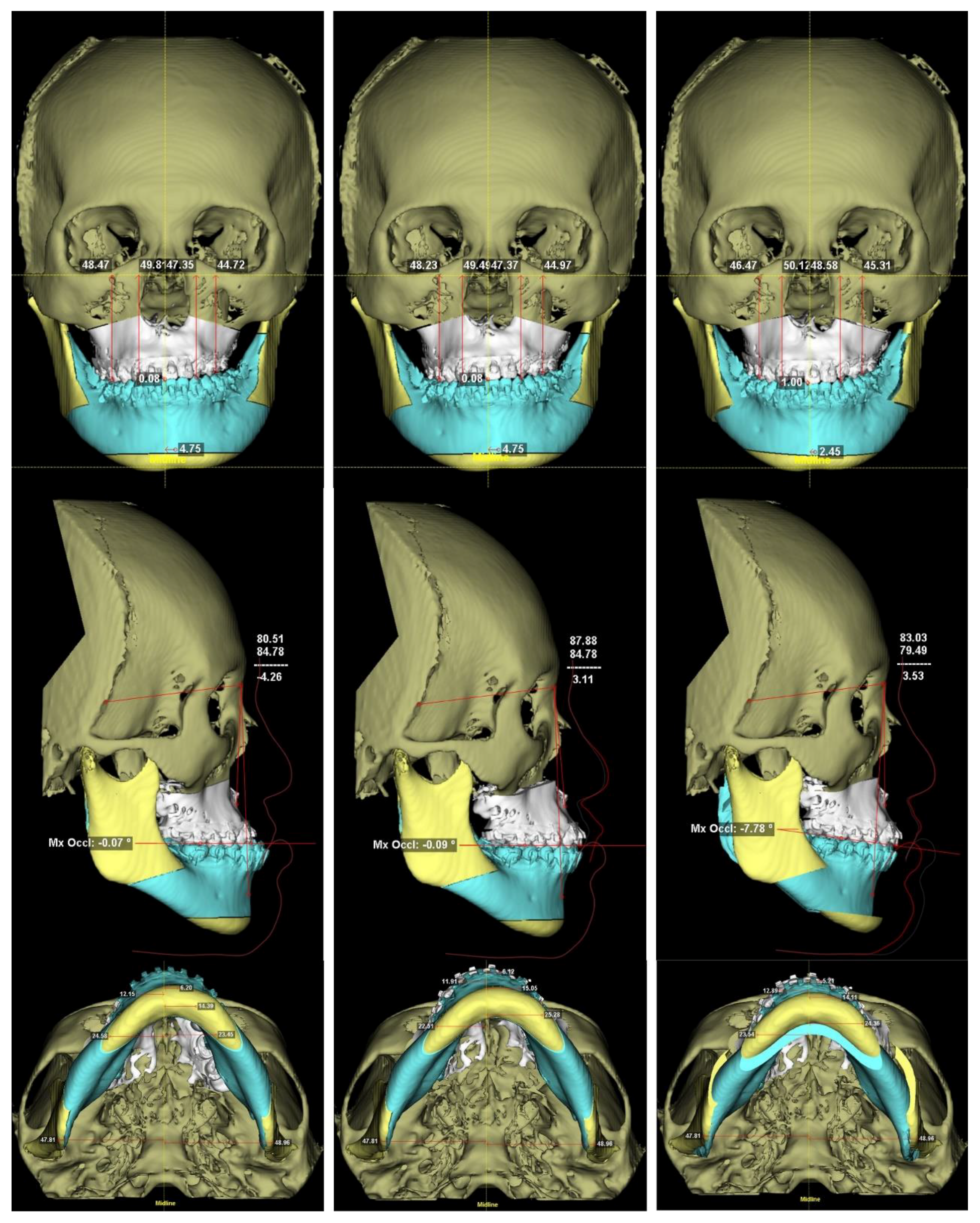Applsci 12 04461 g001