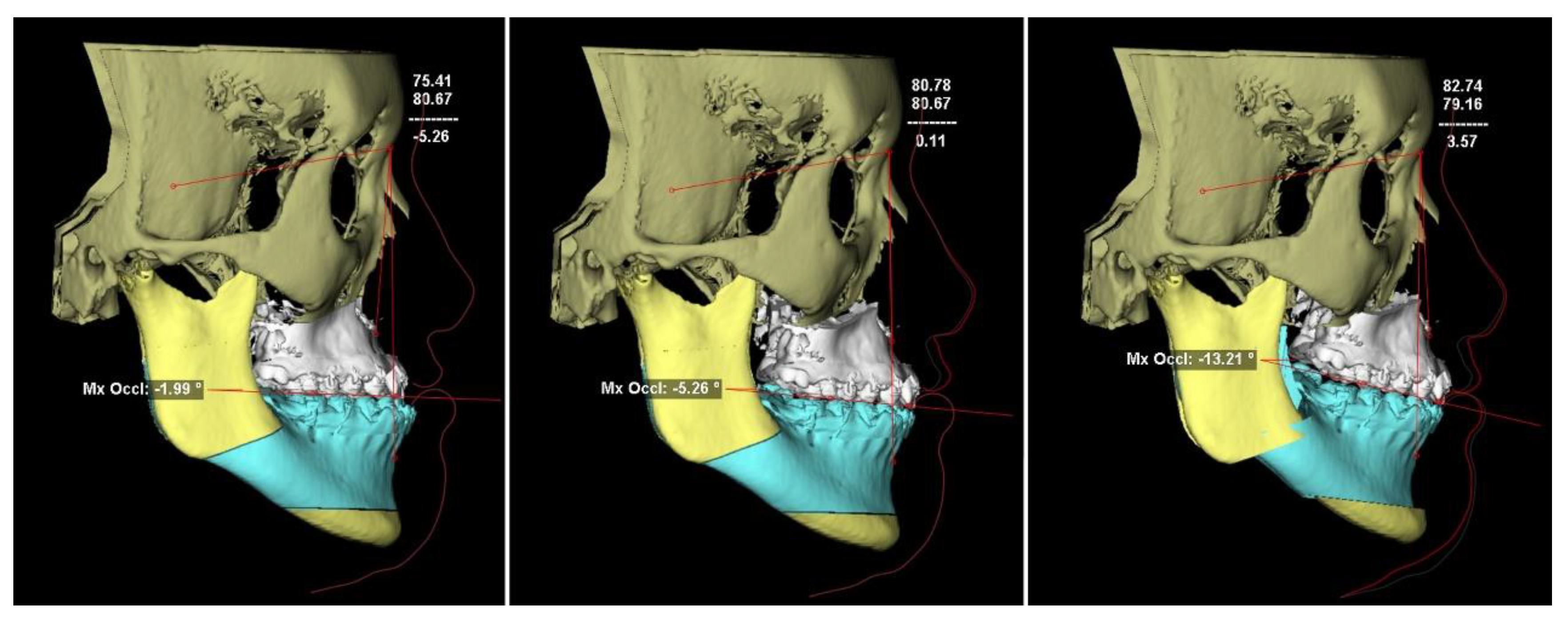 Applsci 12 04461 g003