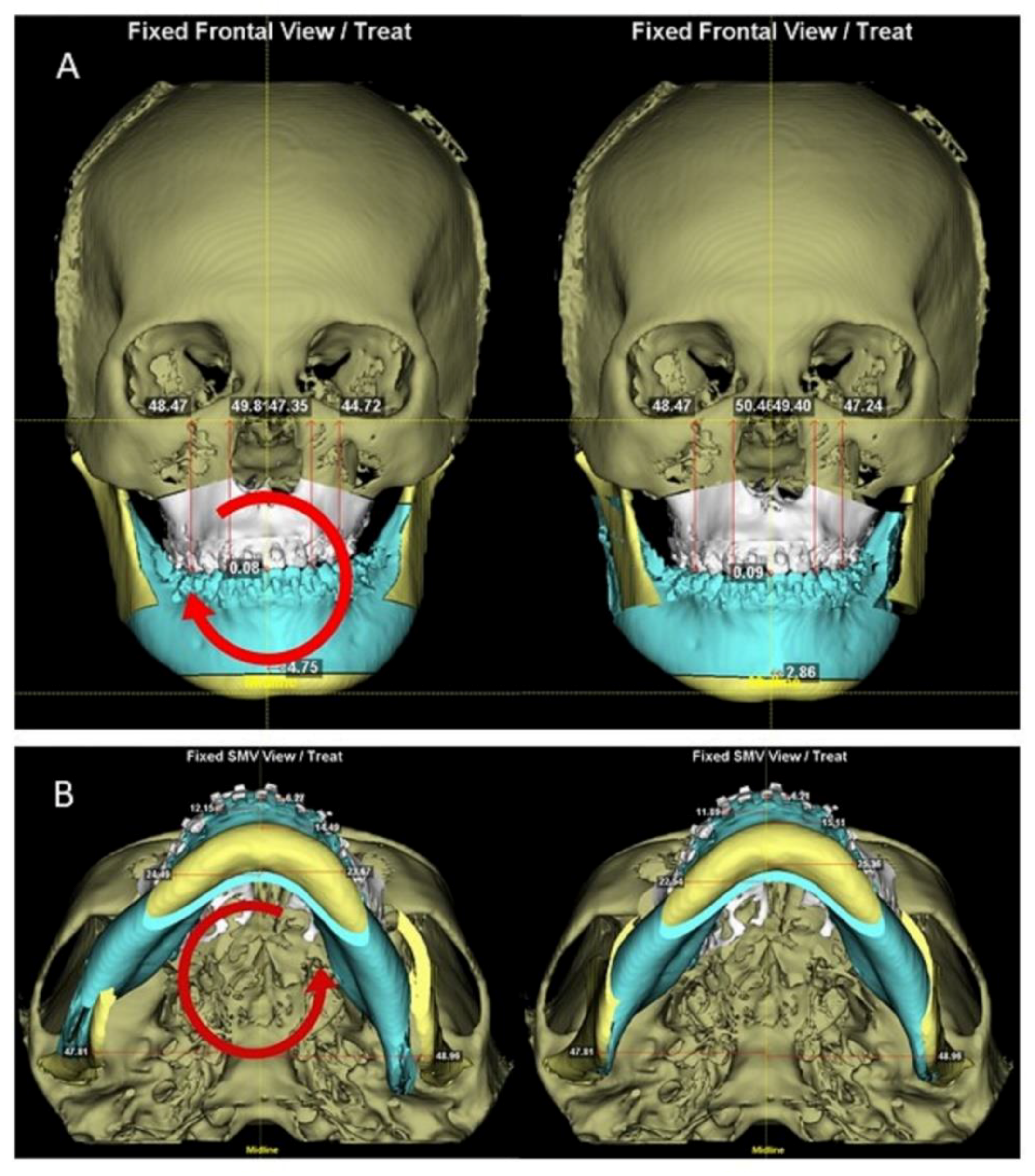 Applsci 12 04461 g004