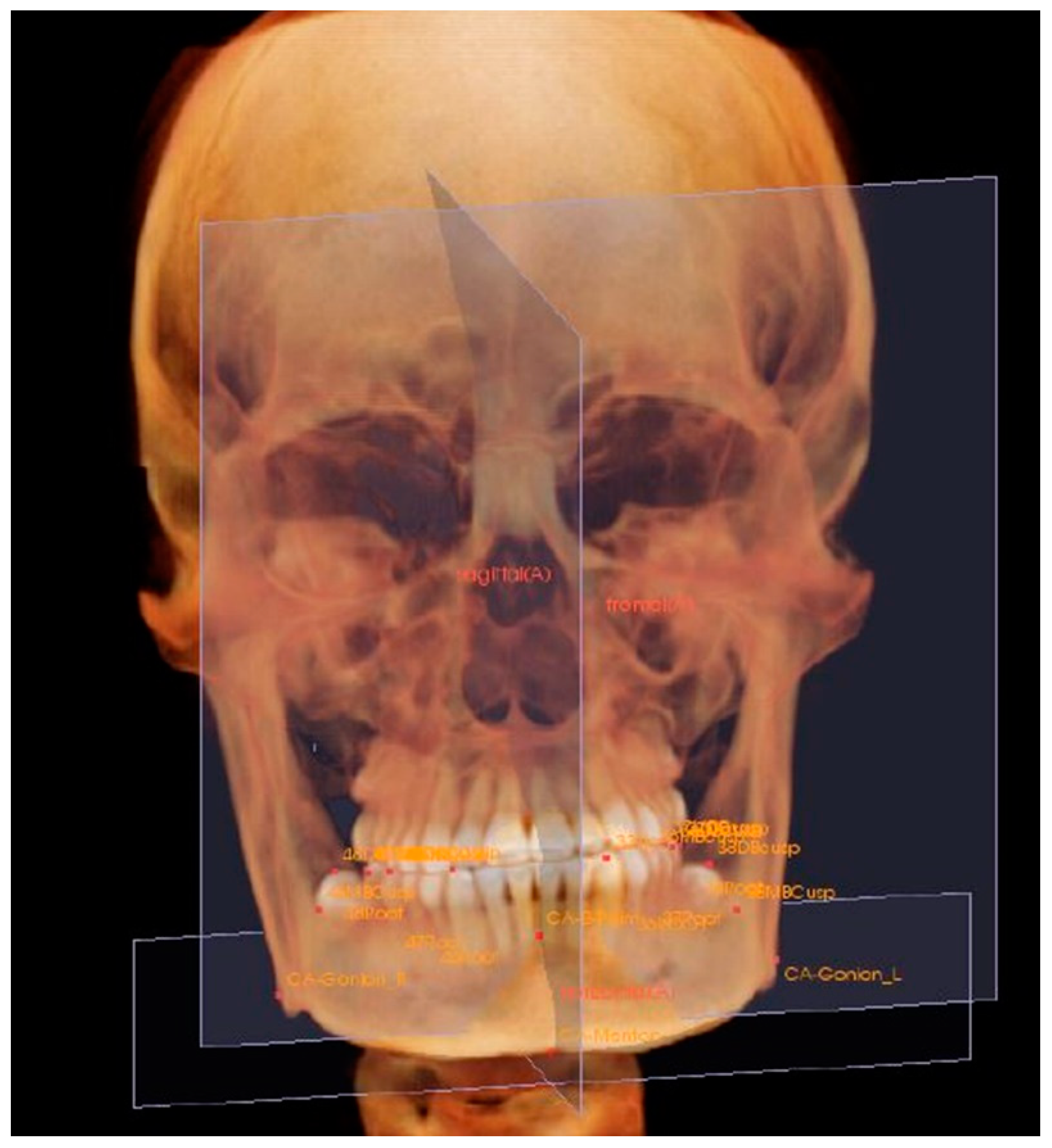 Applsci 12 04613 g002 Applsci 12 04613 g002