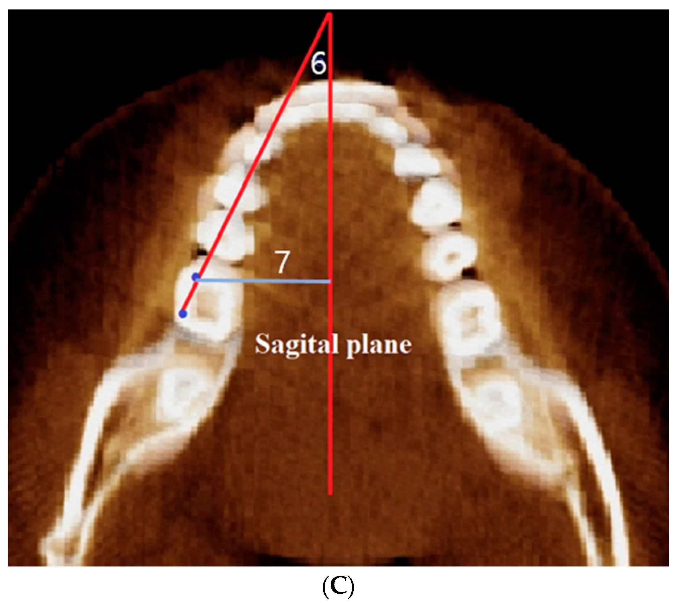 Applsci 12 04613 g003b Applsci 12 04613 g003b