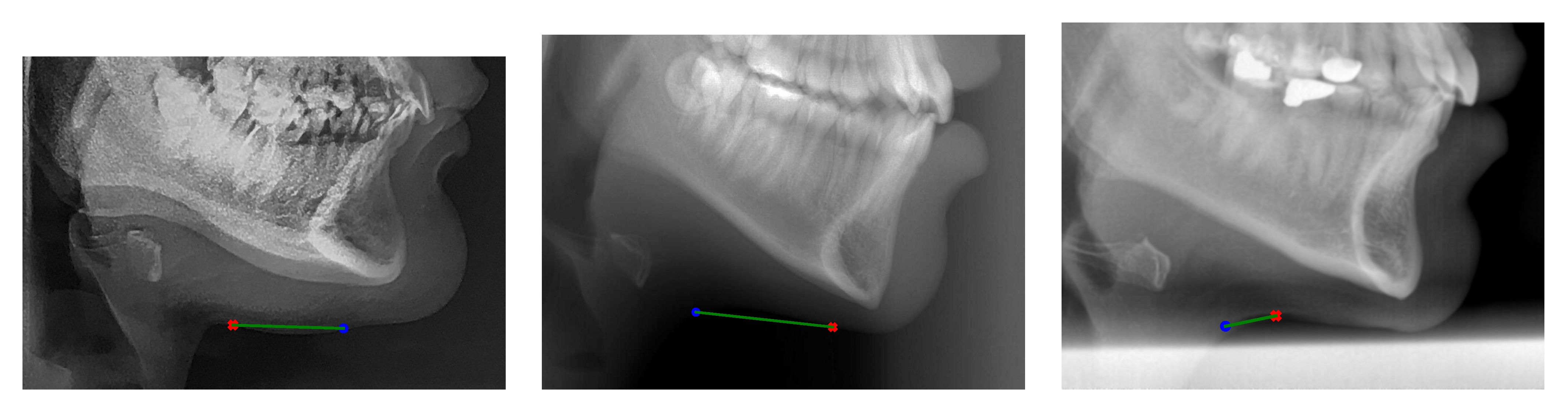 Applsci 12 04644 g005 550