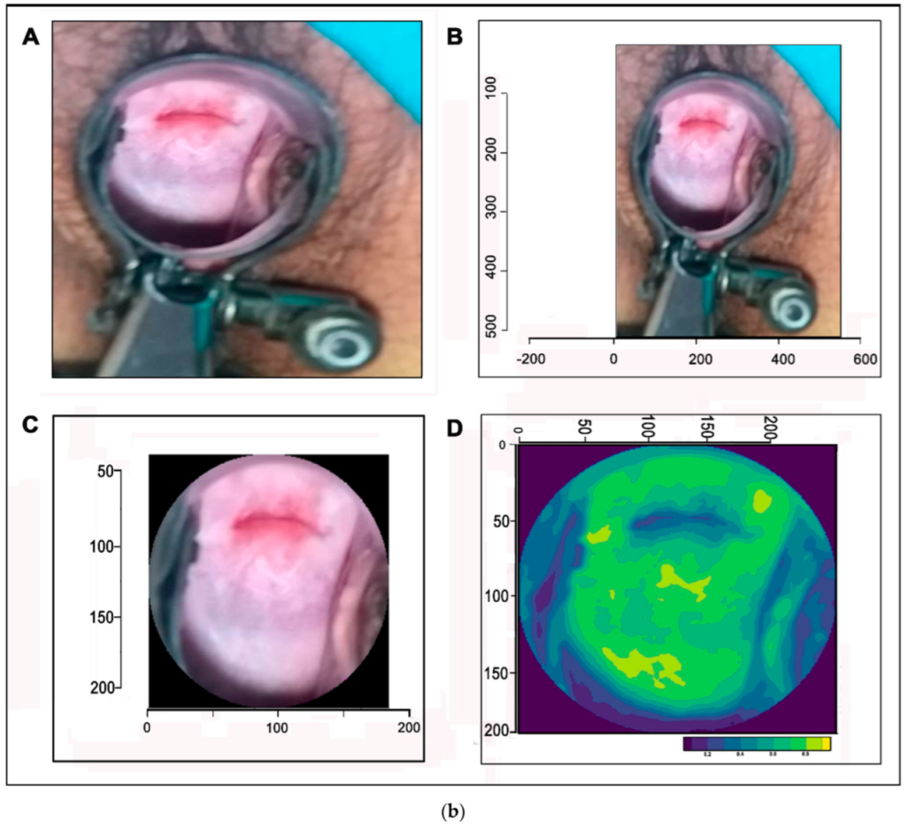 Applsci 12 04661 g002b 550