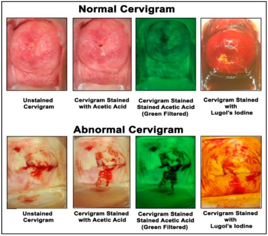 Applsci 12 04661 g005 550