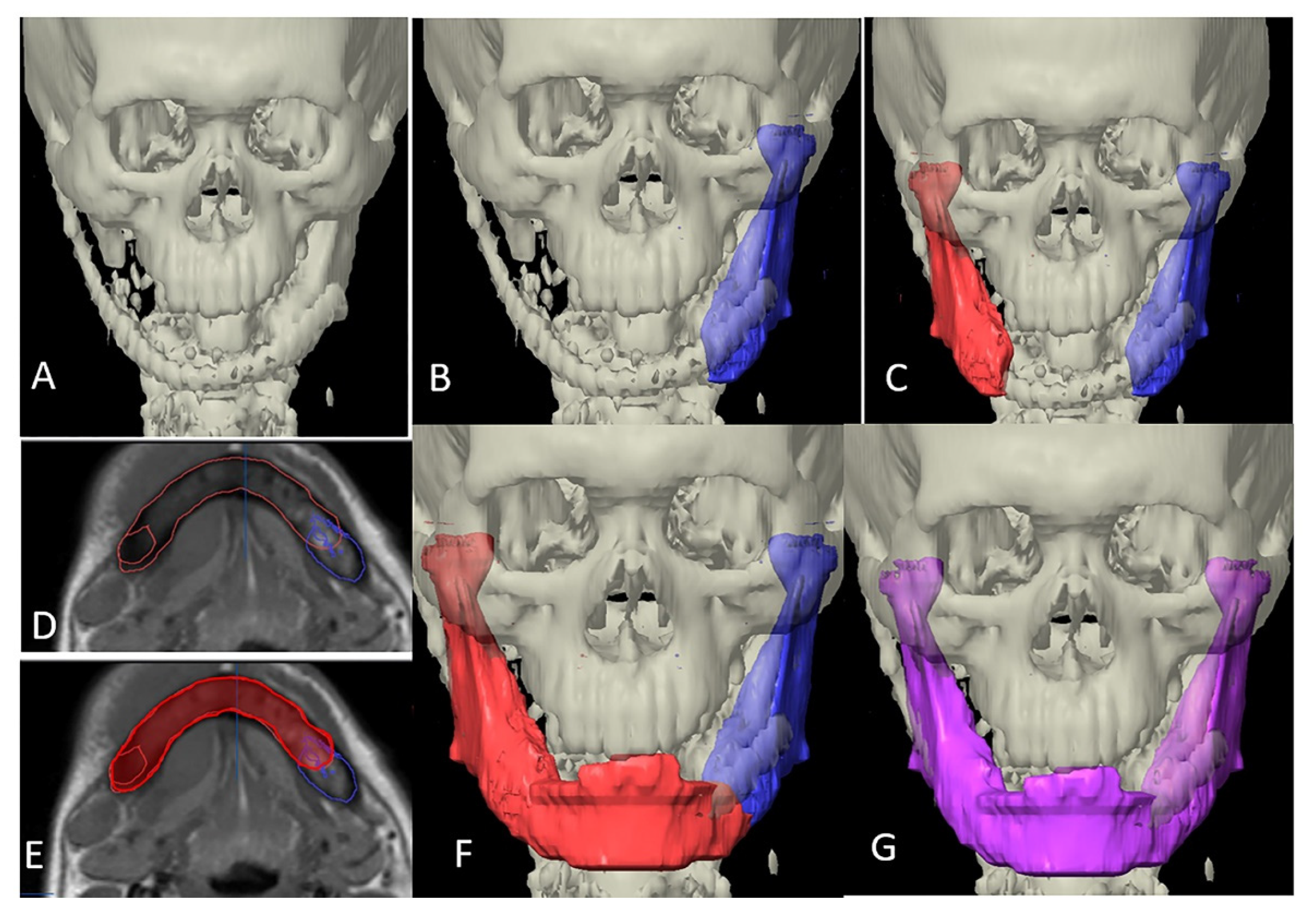 Applsci 12 04672 g003 550