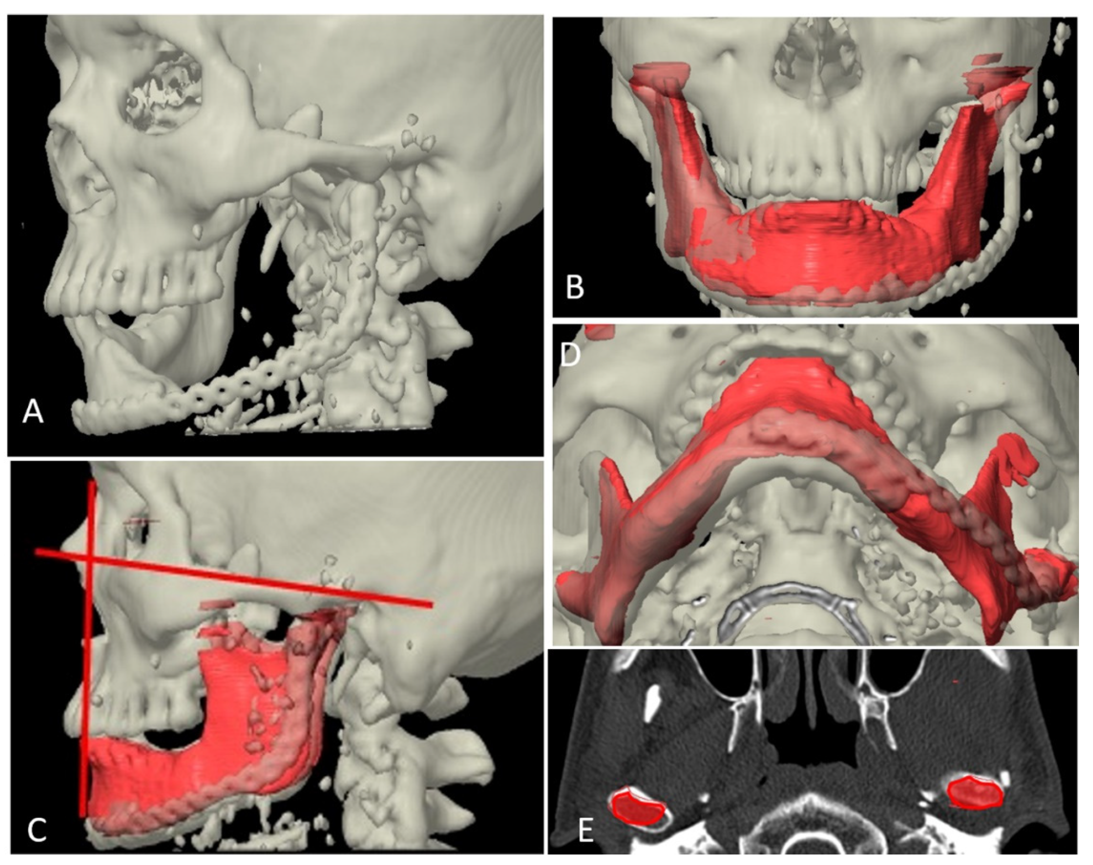 Applsci 12 04672 g004 550