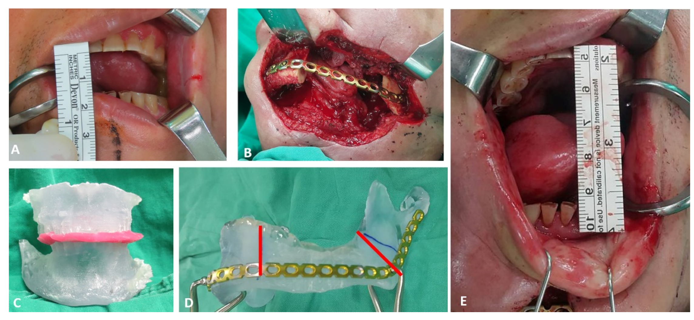 Applsci 12 04672 g007 550