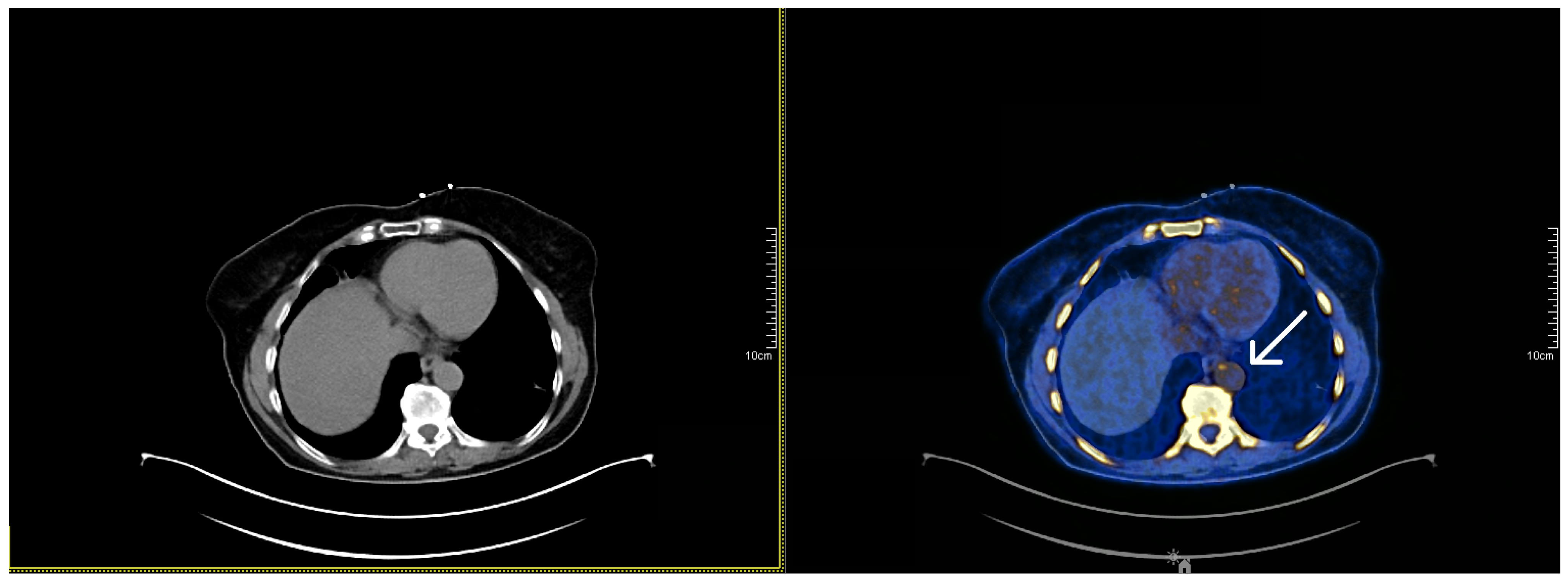 Applsci 12 04704 g001 550