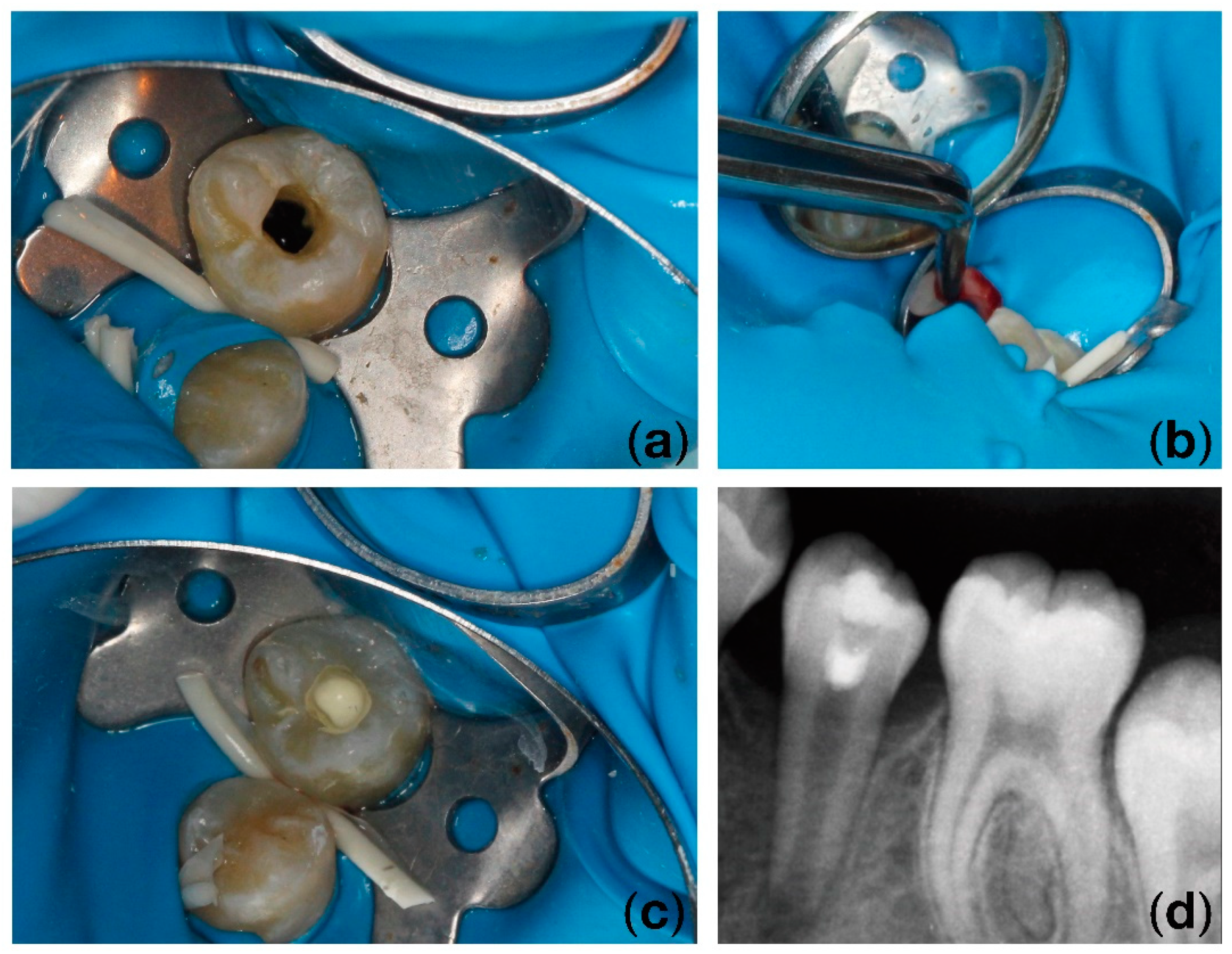 Applsci 12 04751 g004