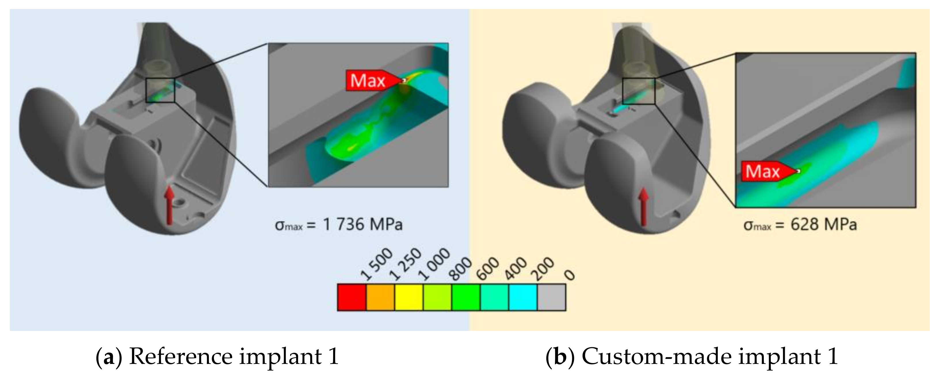 Applsci 12 04787 g004 550