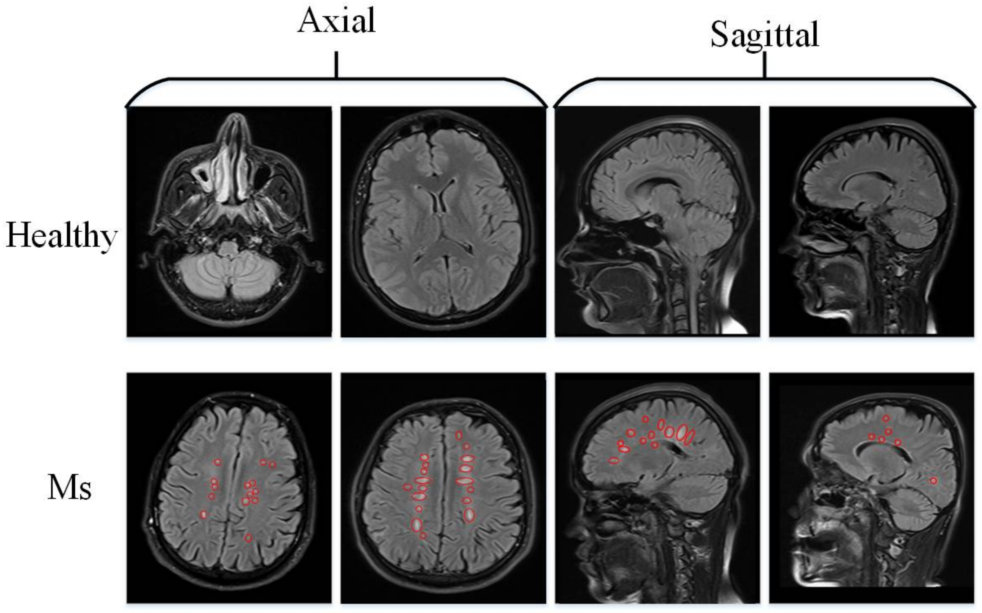 Healthy Female Brain Mri