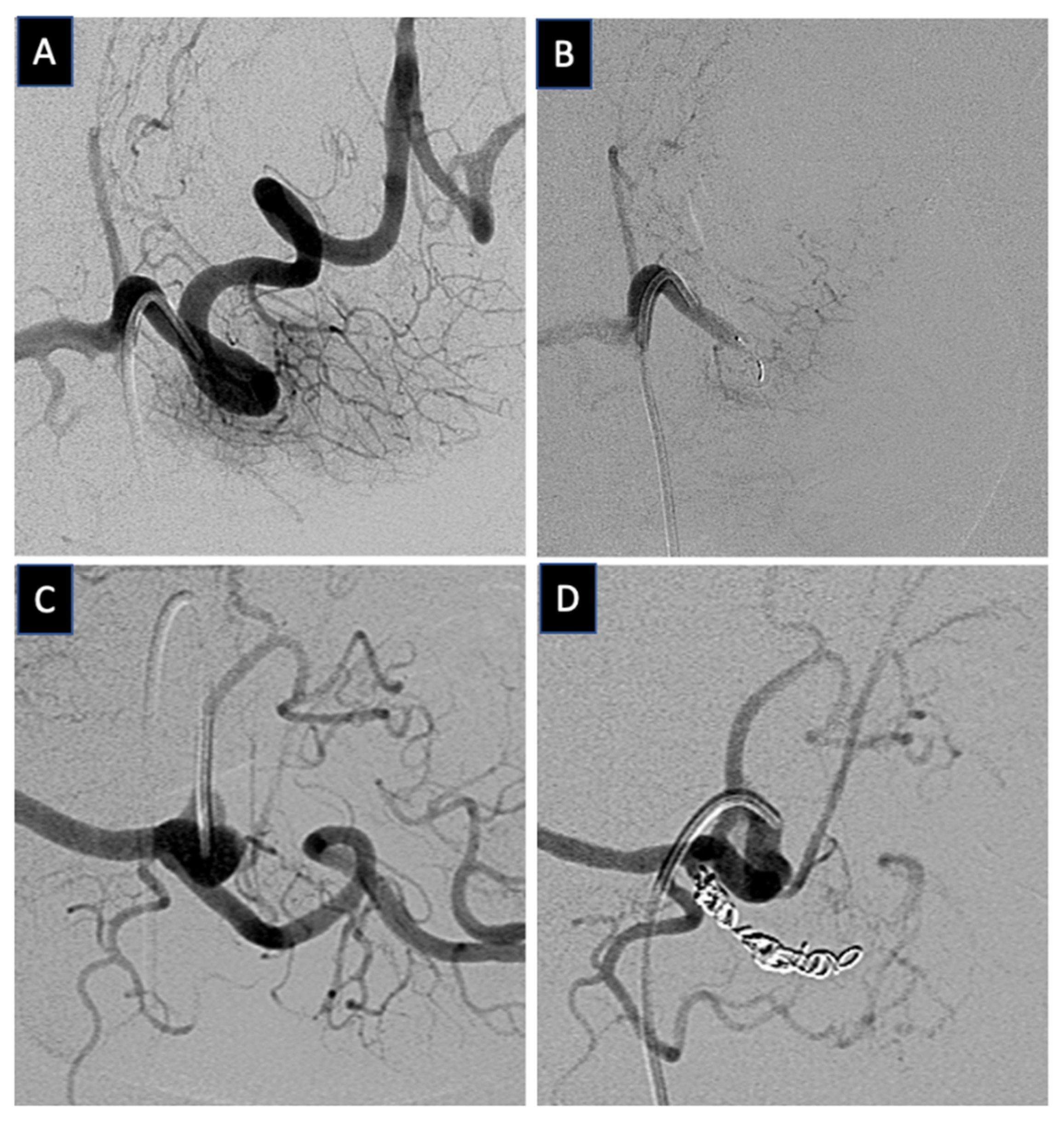 Applsci 12 05262 g001 550
