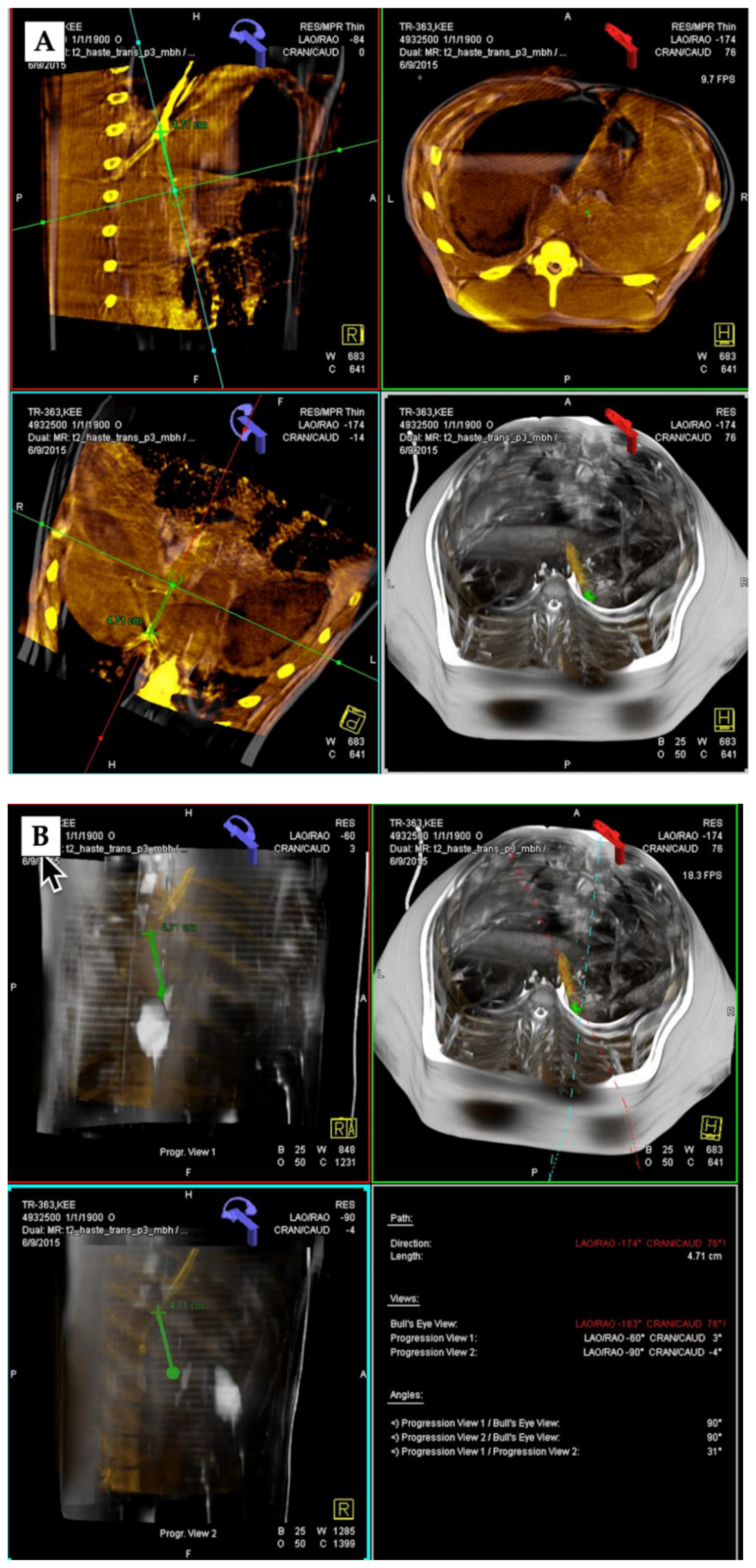 Applsci 12 05267 g002 Applsci 12 05267 g002