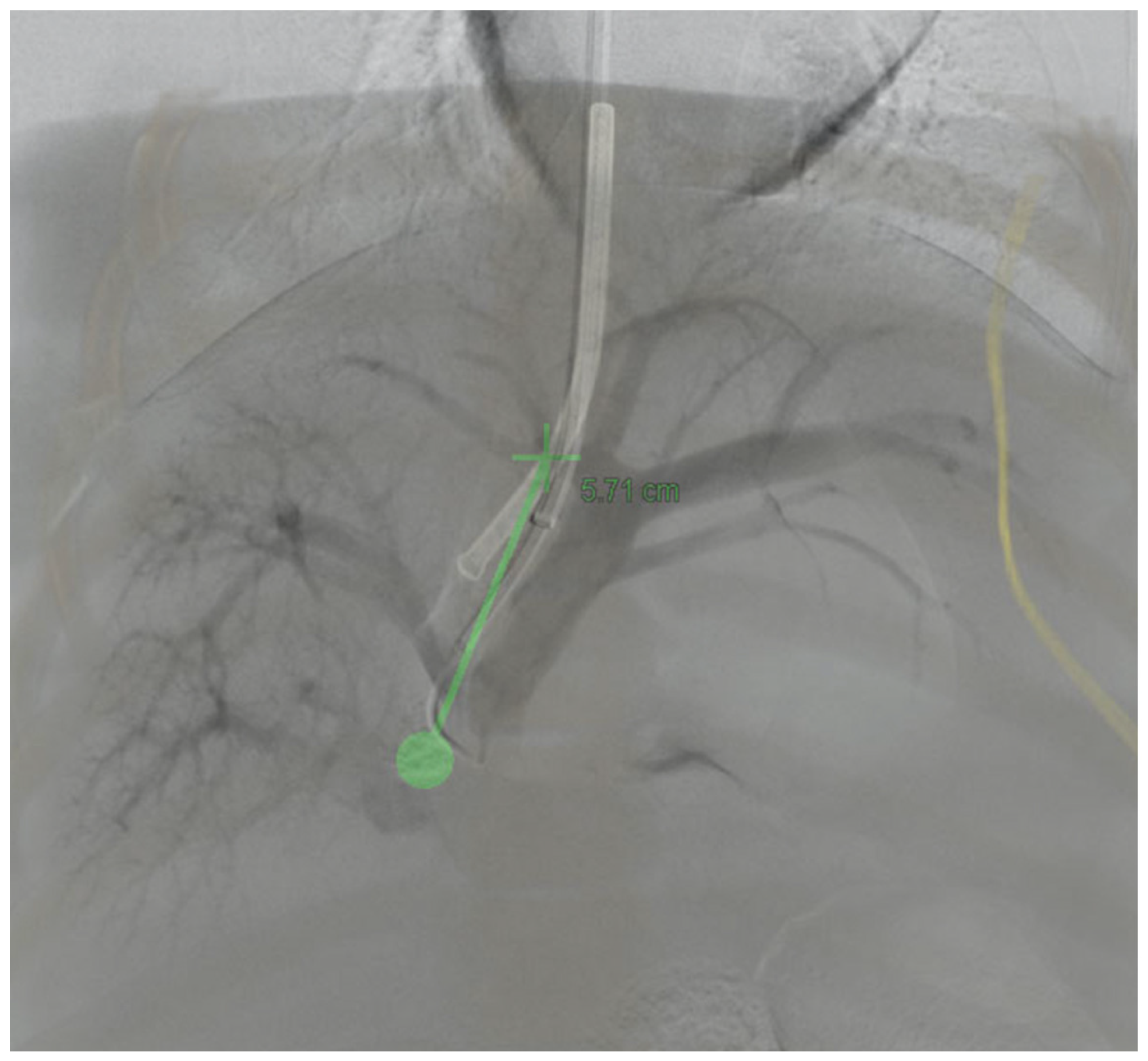 Applsci 12 05267 g004 Applsci 12 05267 g004