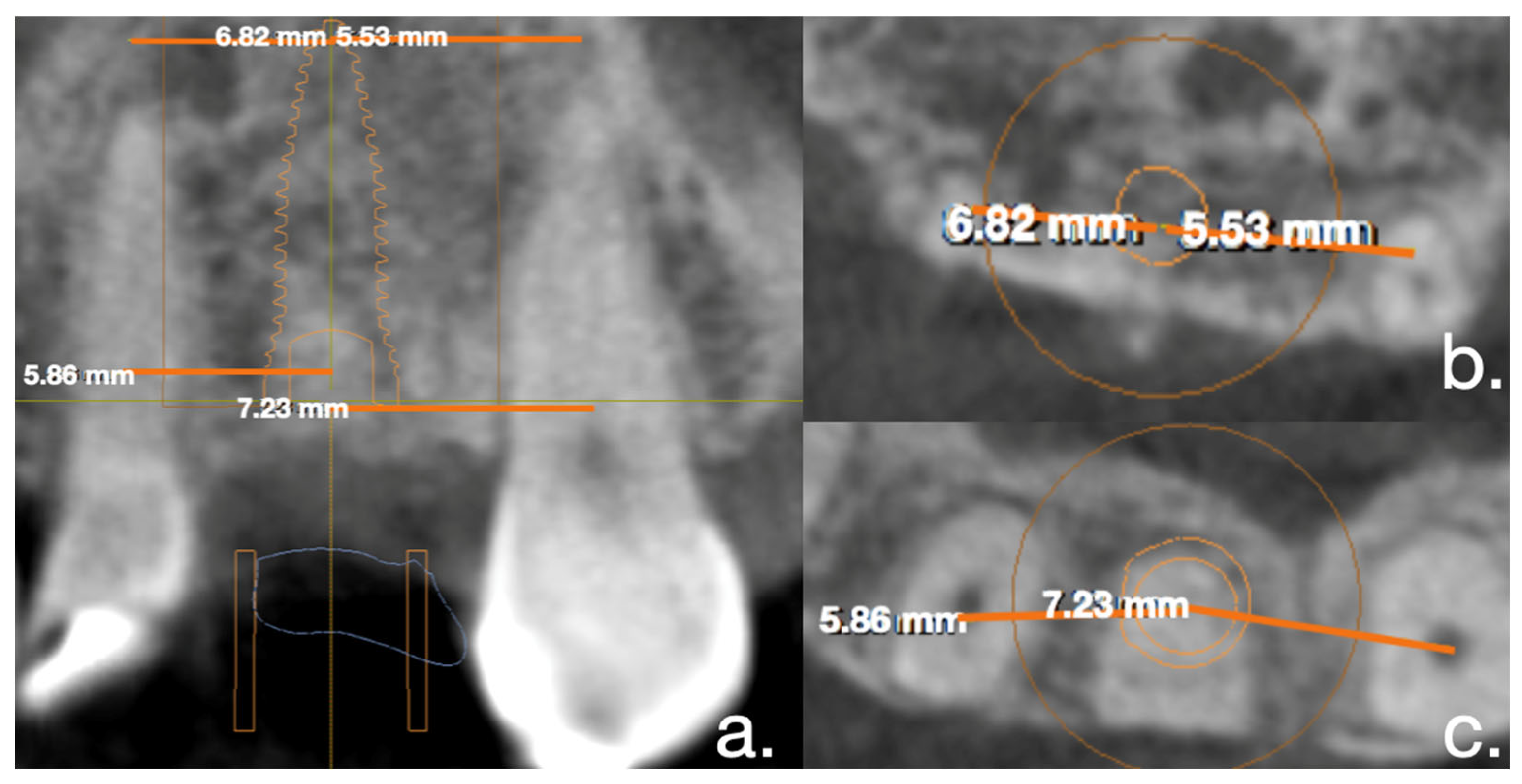 Applsci 12 05461 g002 550