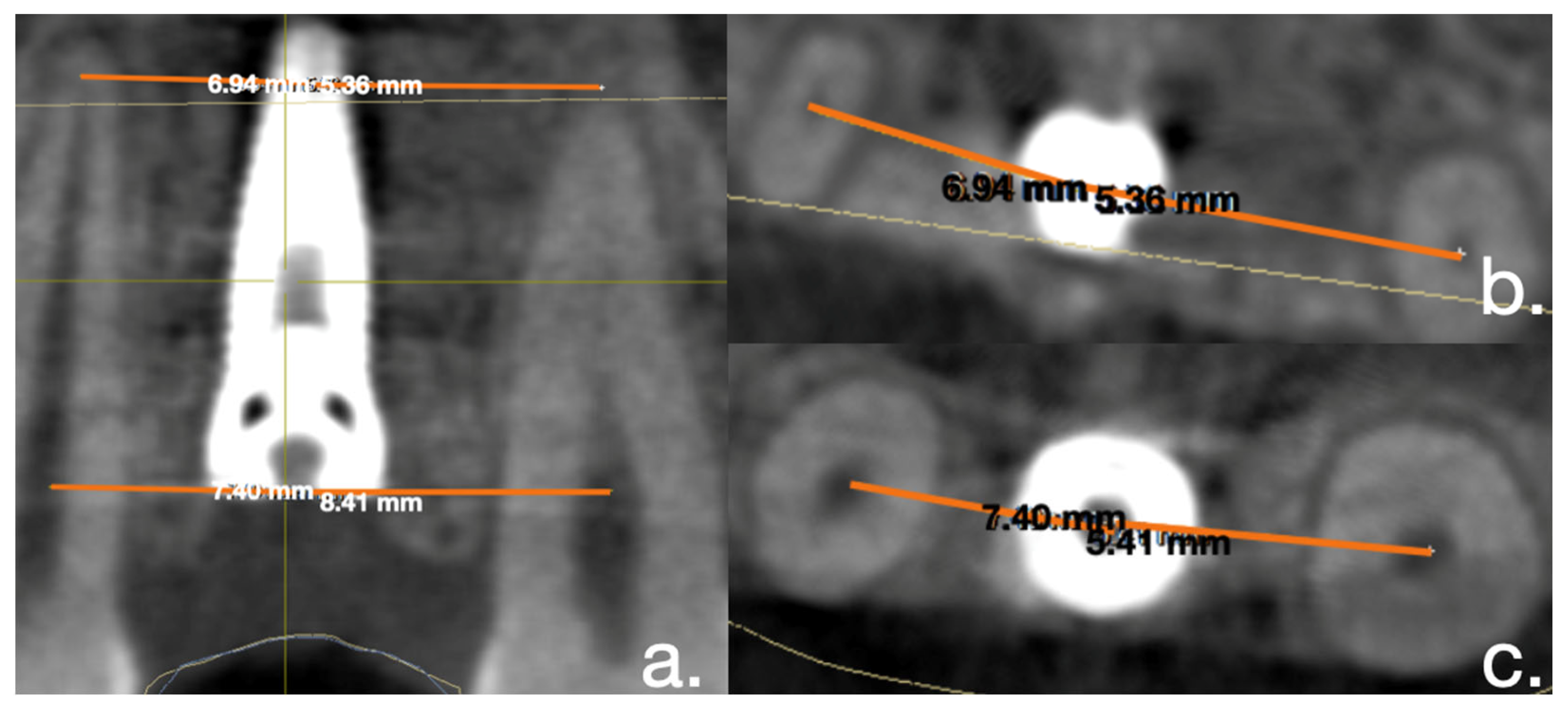 Applsci 12 05461 g003 550