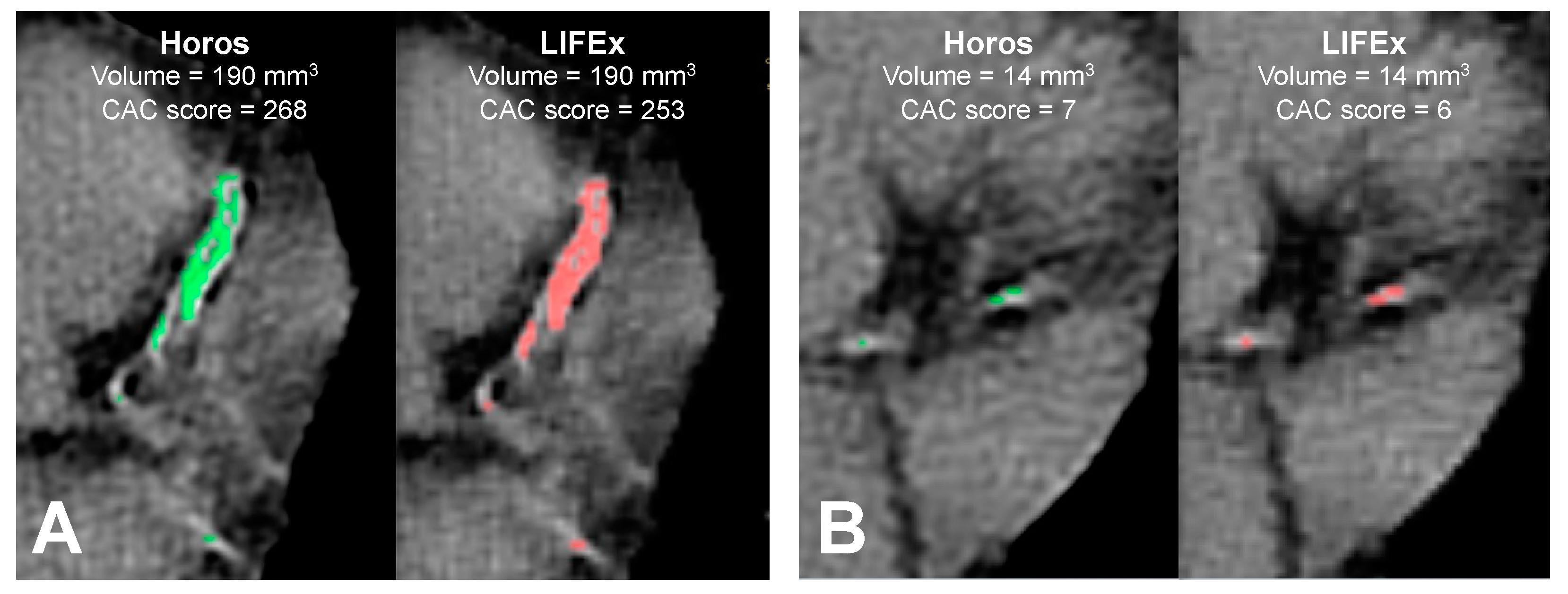 Applsci 12 05468 g004