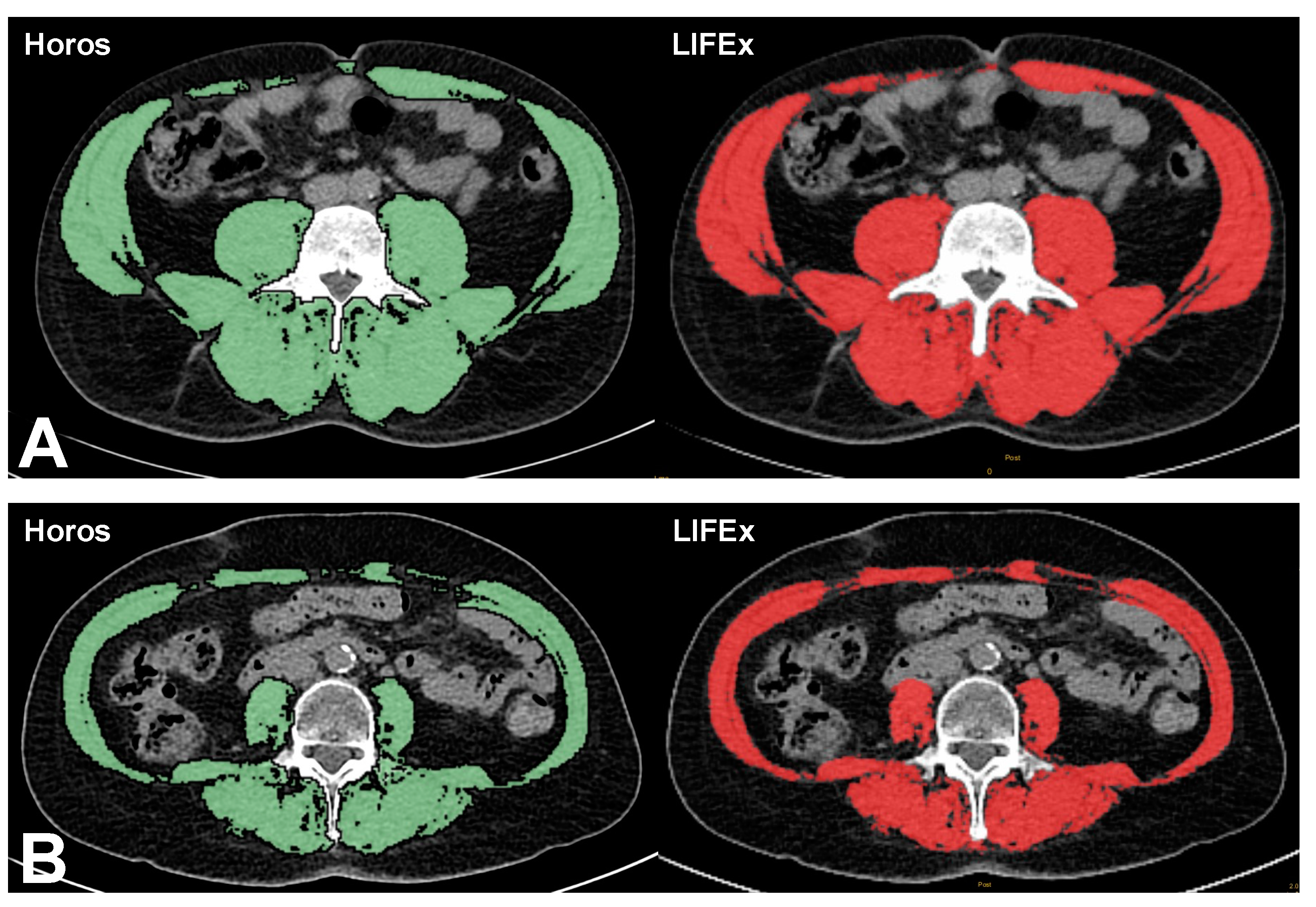 Applsci 12 05468 g007