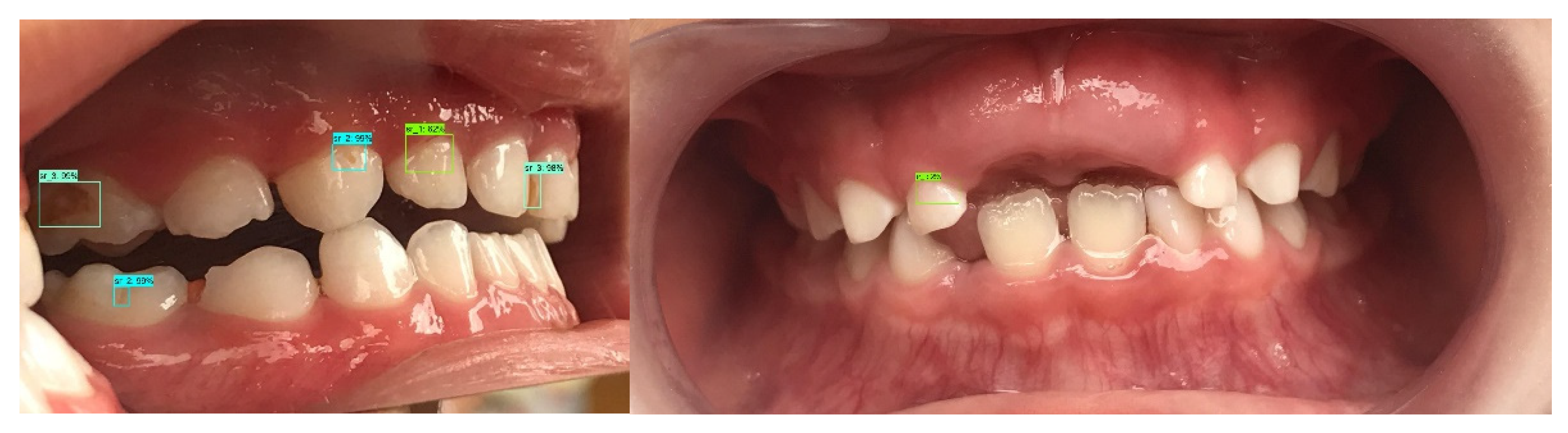 Applsci 12 05504 g005 Applsci 12 05504 g005