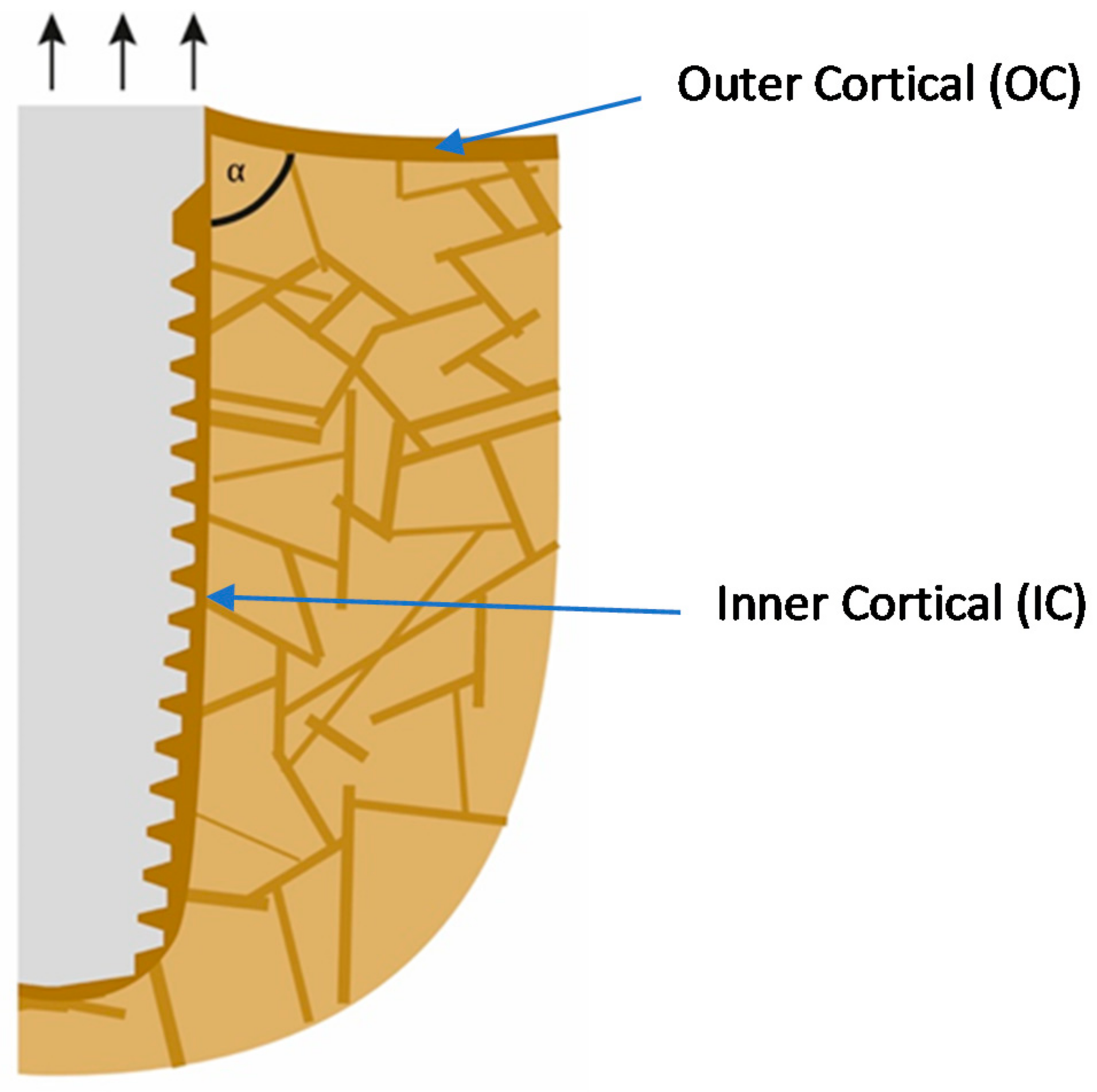 Zero Peri-implantitis Concept インプラント周囲炎 インプラント周囲炎ゼロコンセプト: 科学的根拠に基づいた多角的