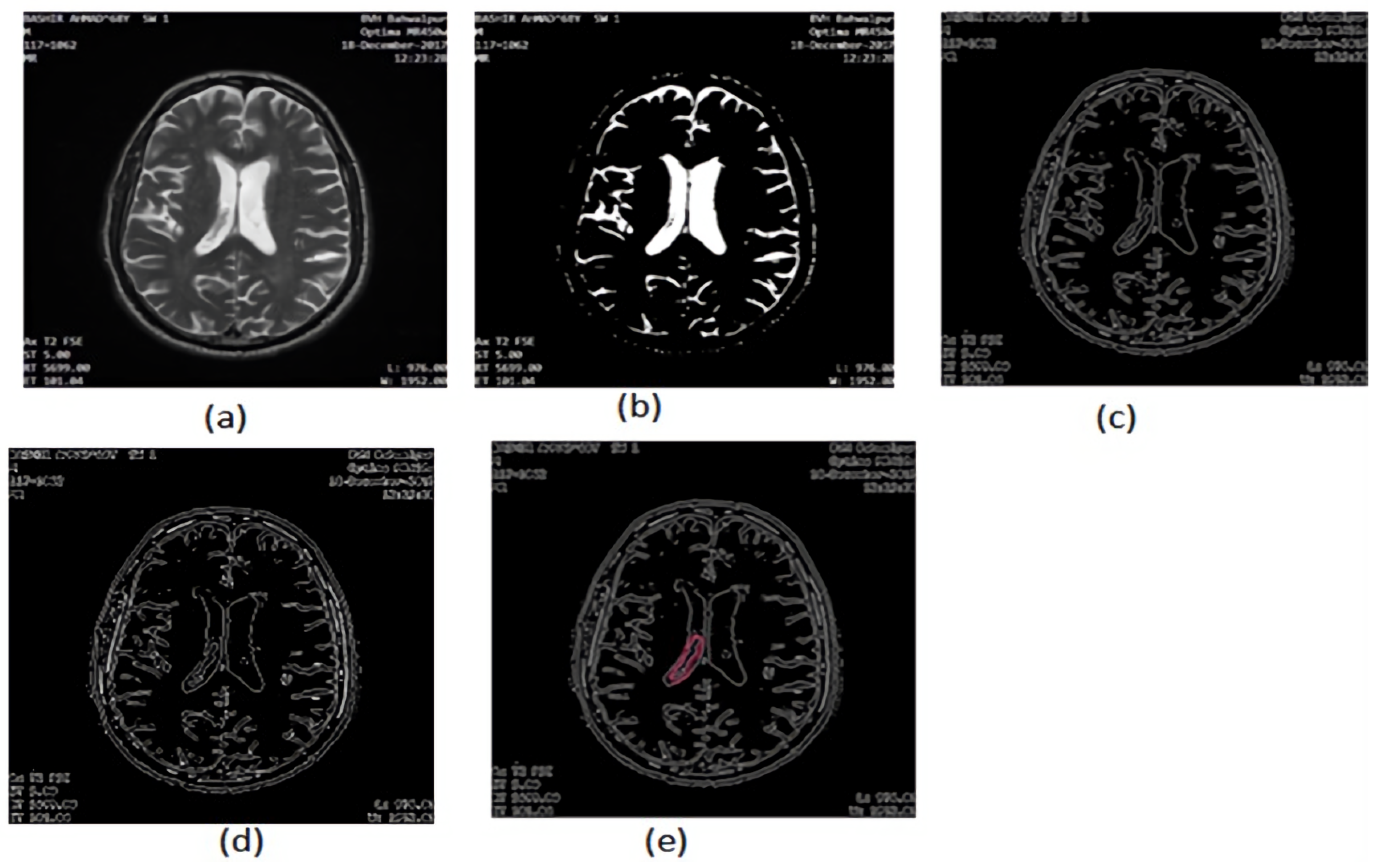 Applsci 12 05744 g006 550