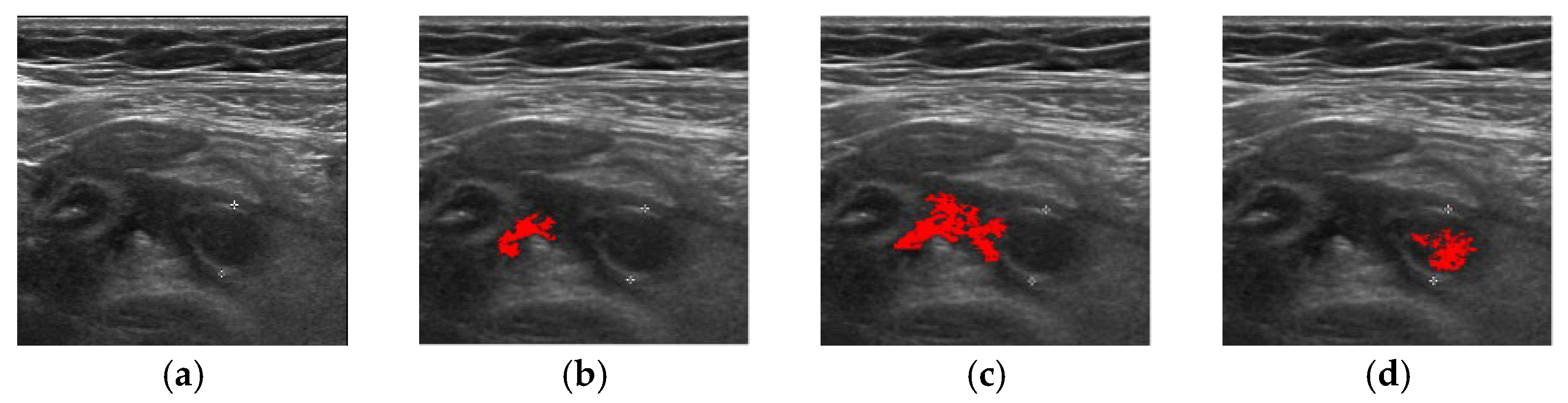 Applsci 12 05753 g005 Applsci 12 05753 g005