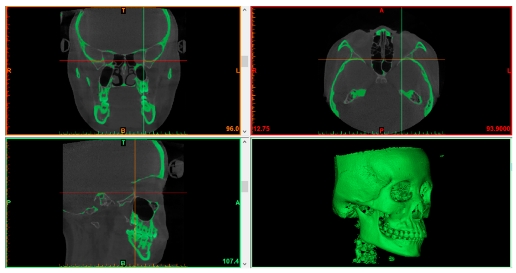 Applsci 12 05814 g002