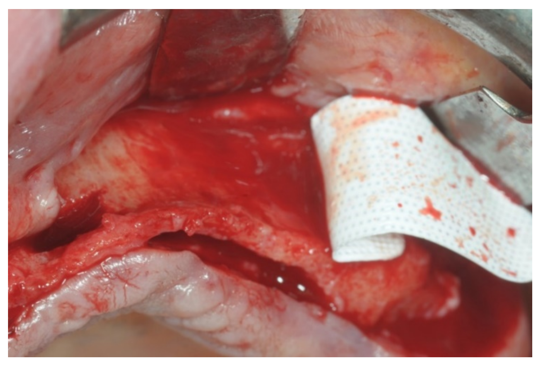 Applsci 12 05889 g001 550