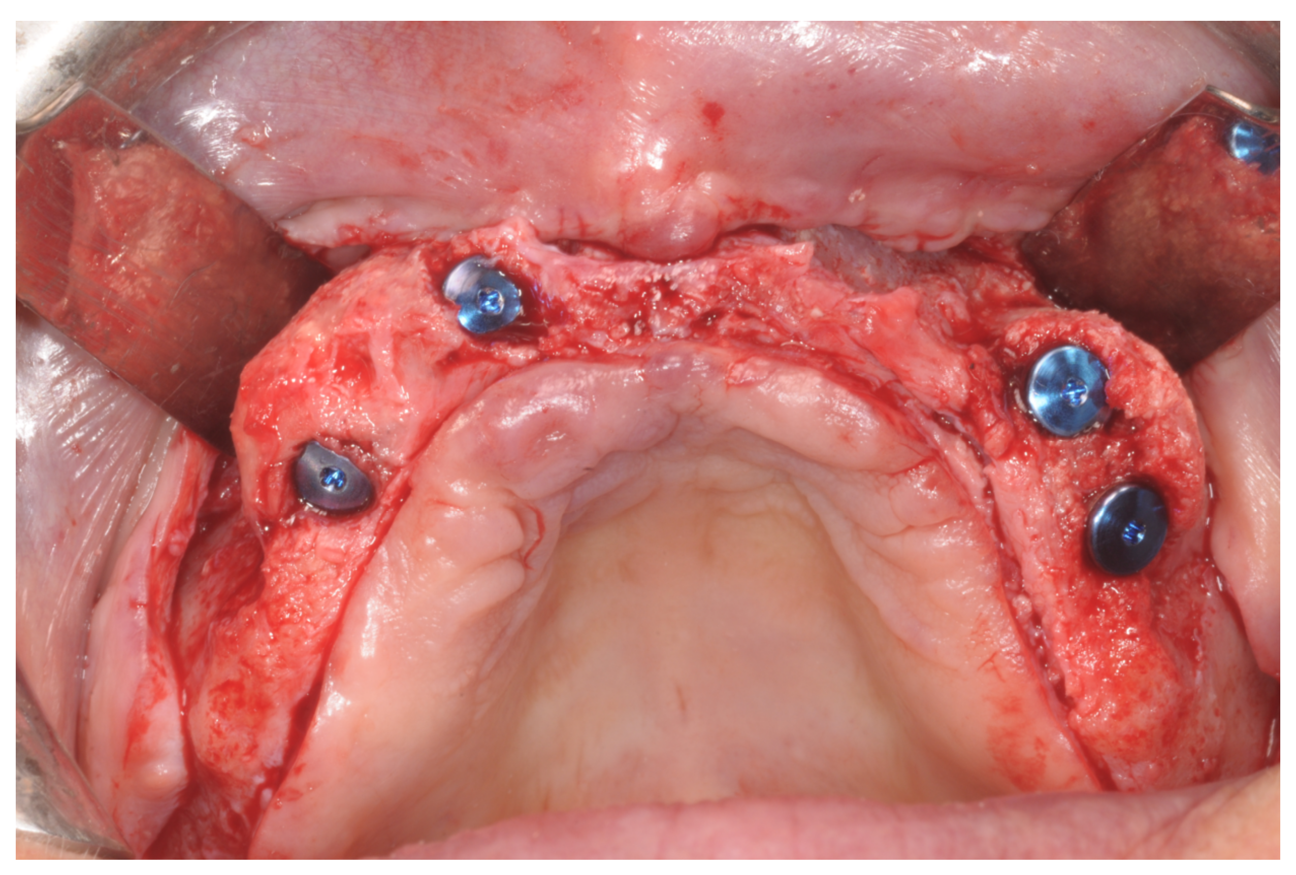 Applsci 12 05889 g007 550