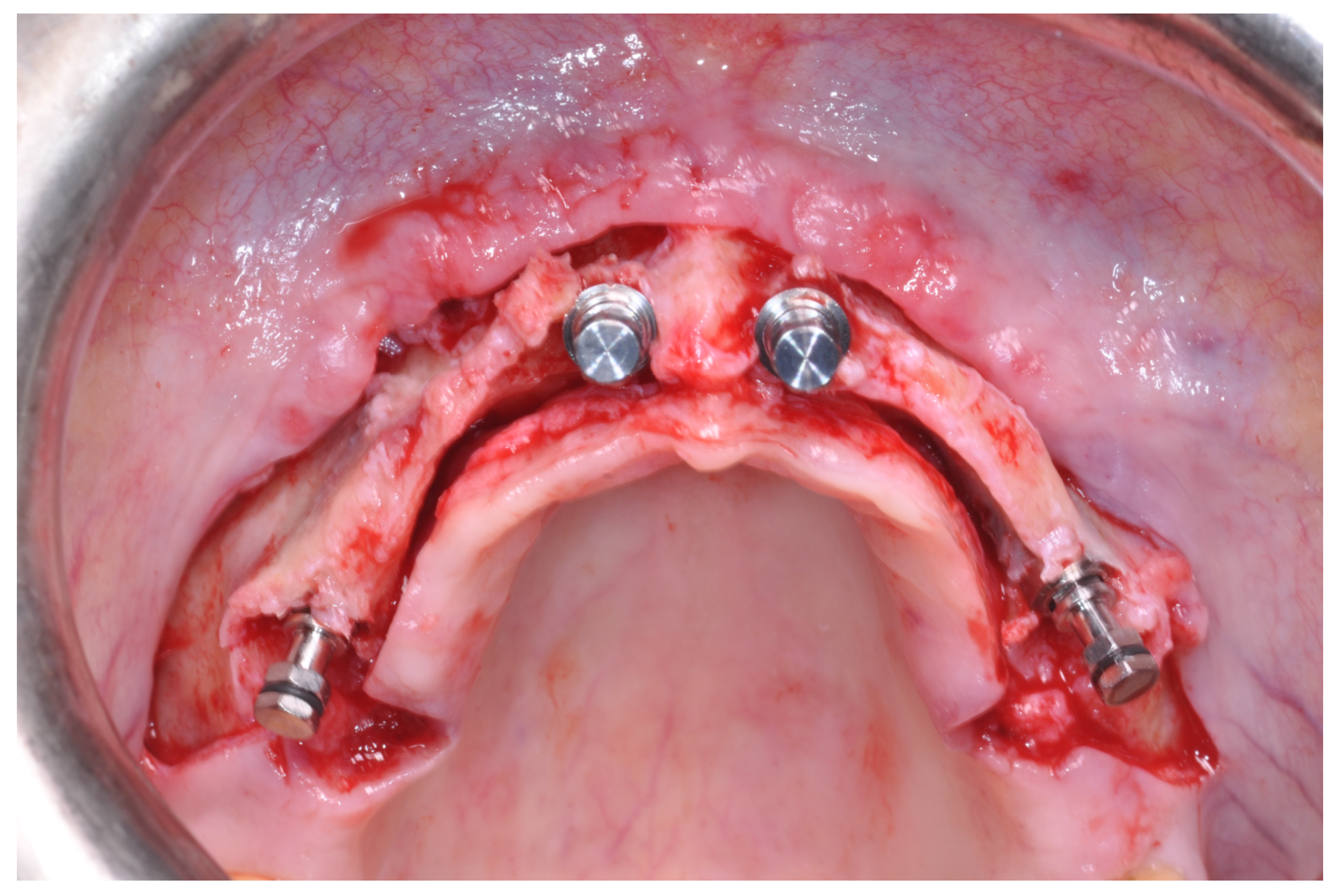 Applsci 12 05889 g009 550