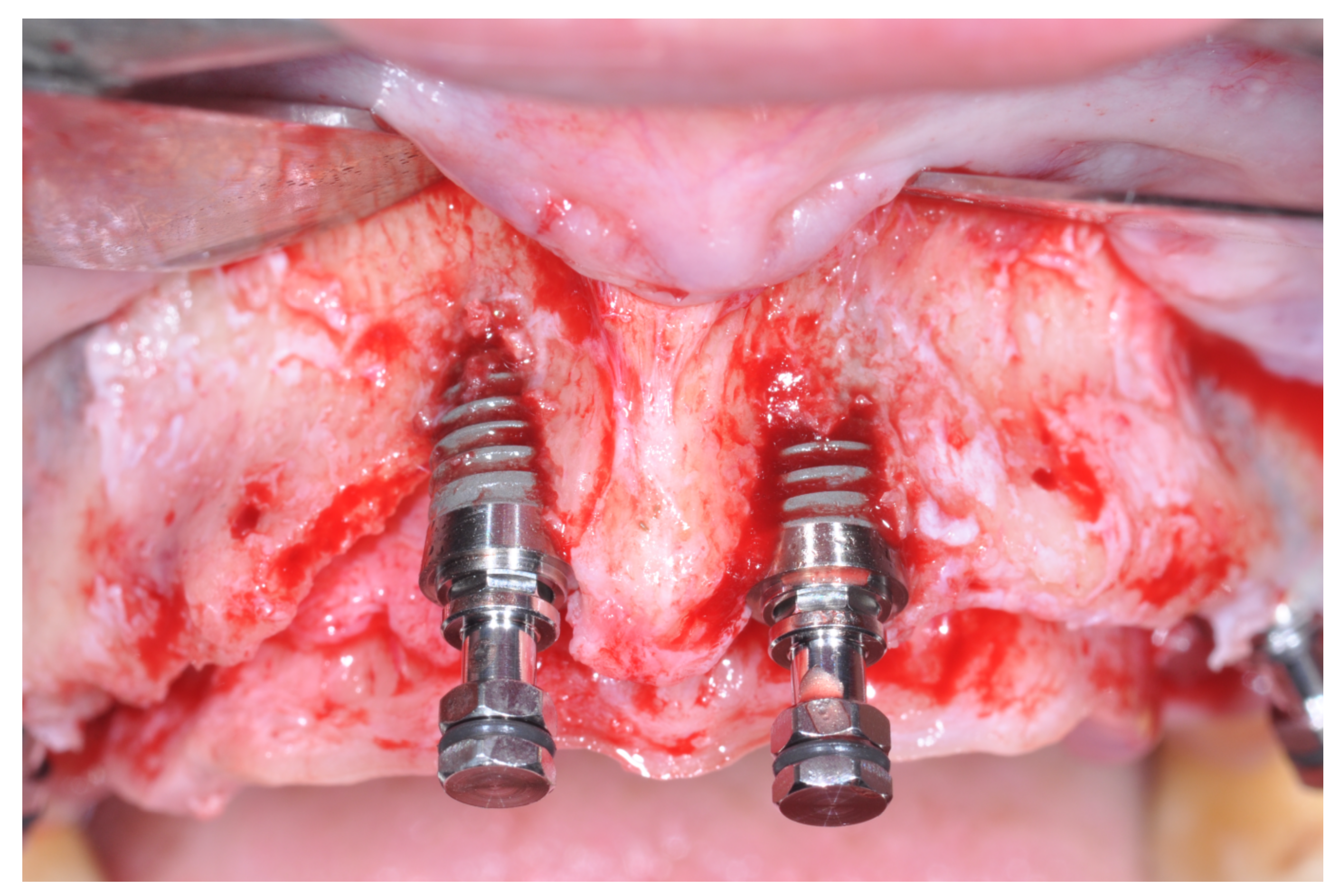 Applsci 12 05889 g010 550