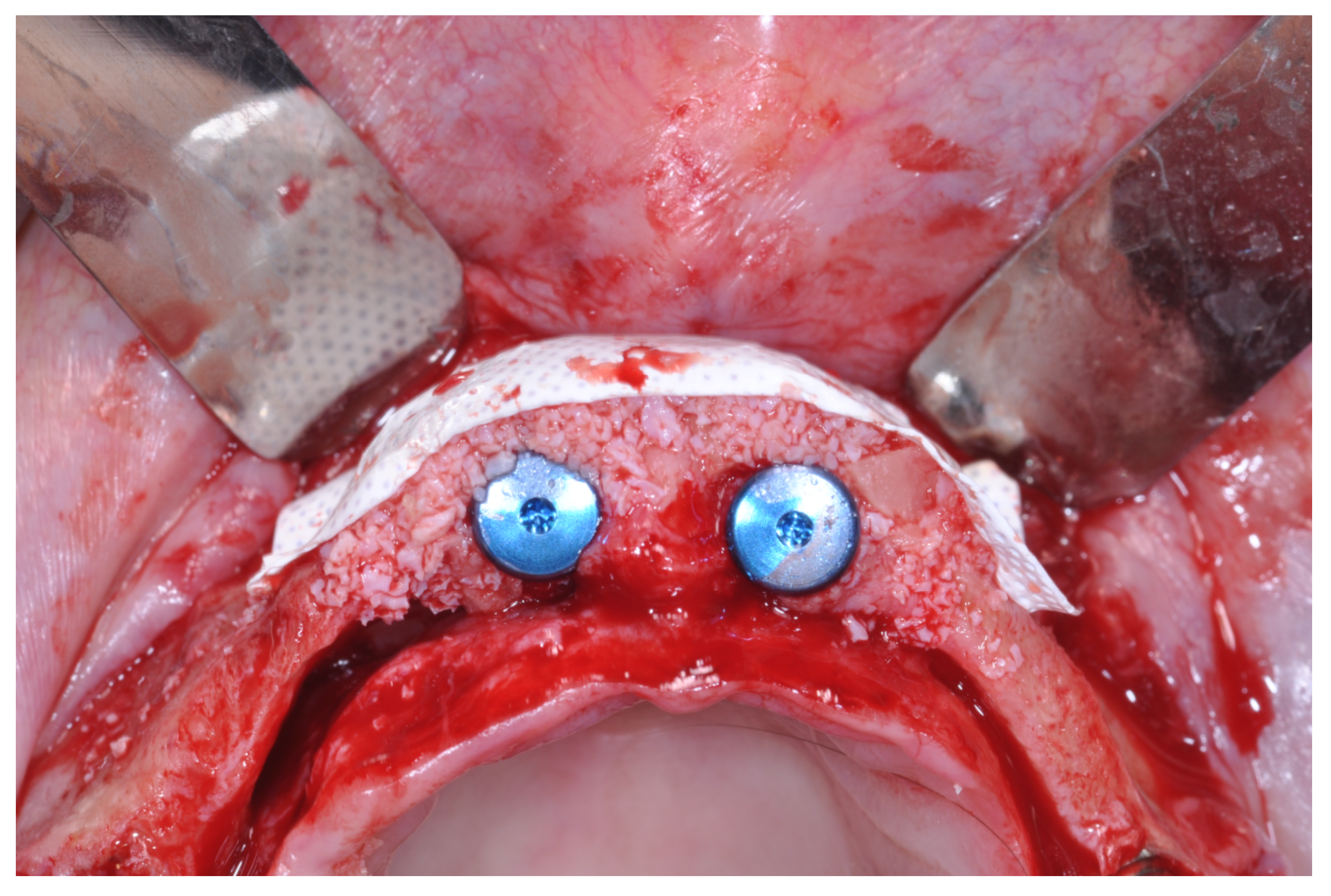 Applsci 12 05889 g011 550