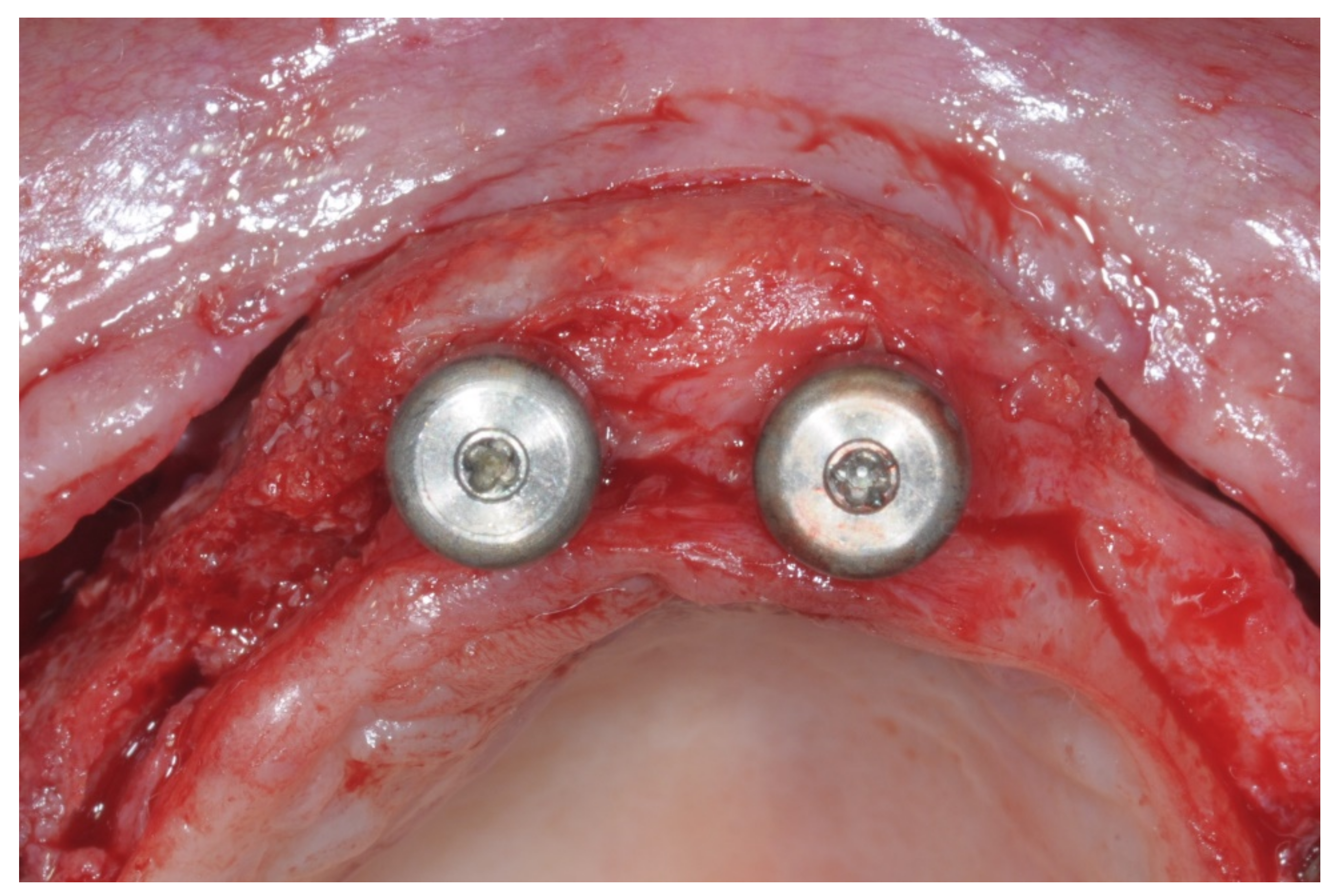 Applsci 12 05889 g014 550