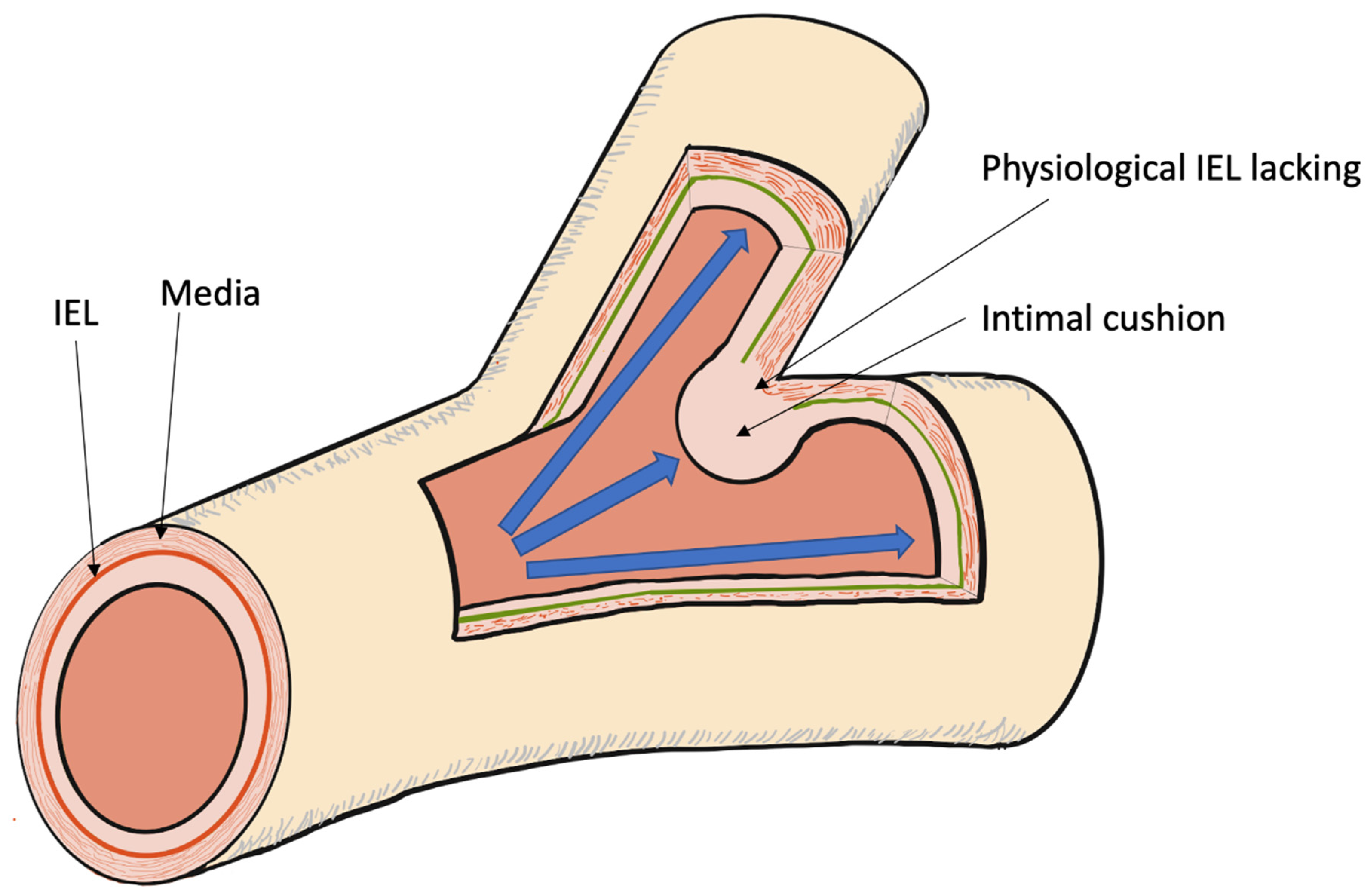 Applied Sciences Free FullText The Cerebral Arterial Wall in the