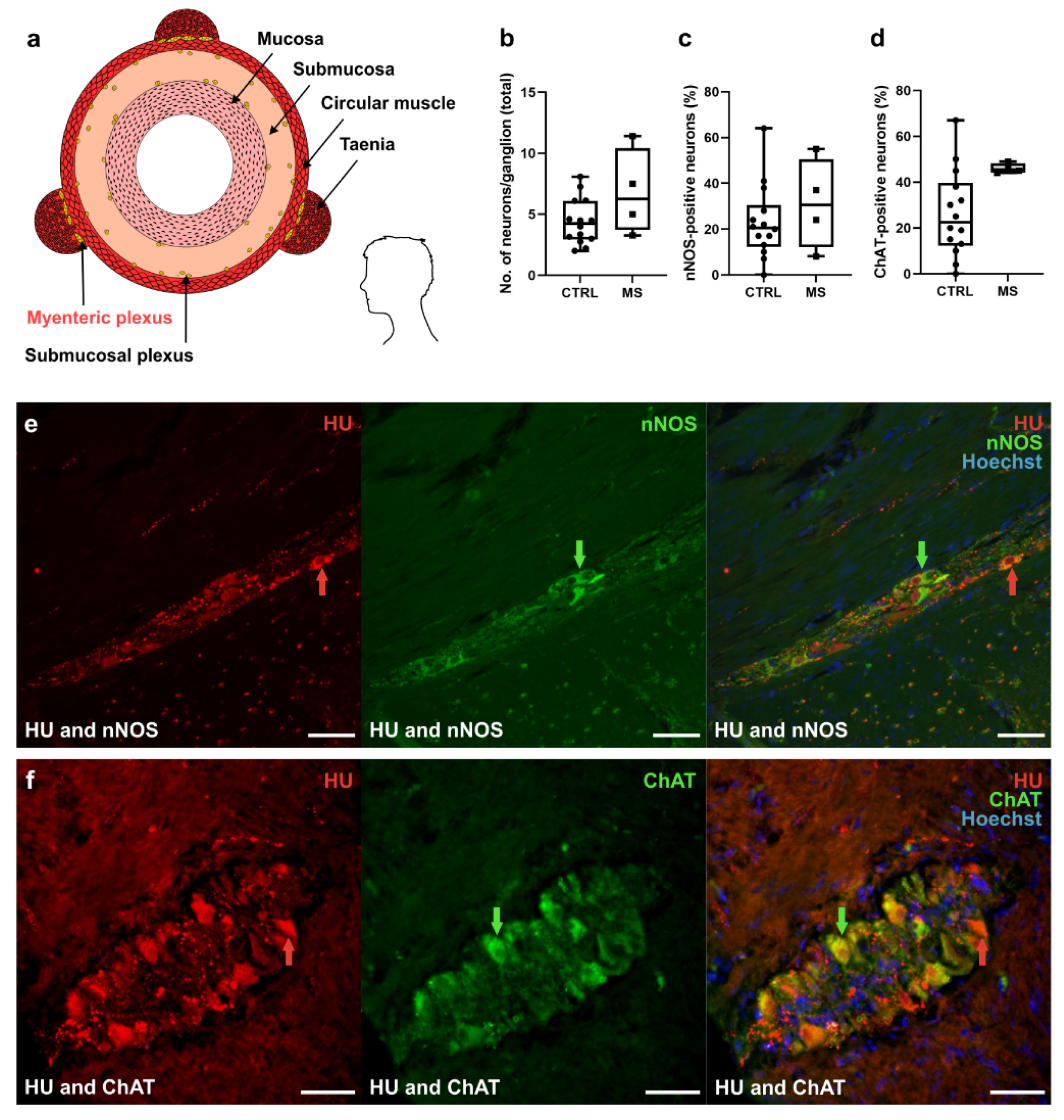 Applsci 12 05974 g005