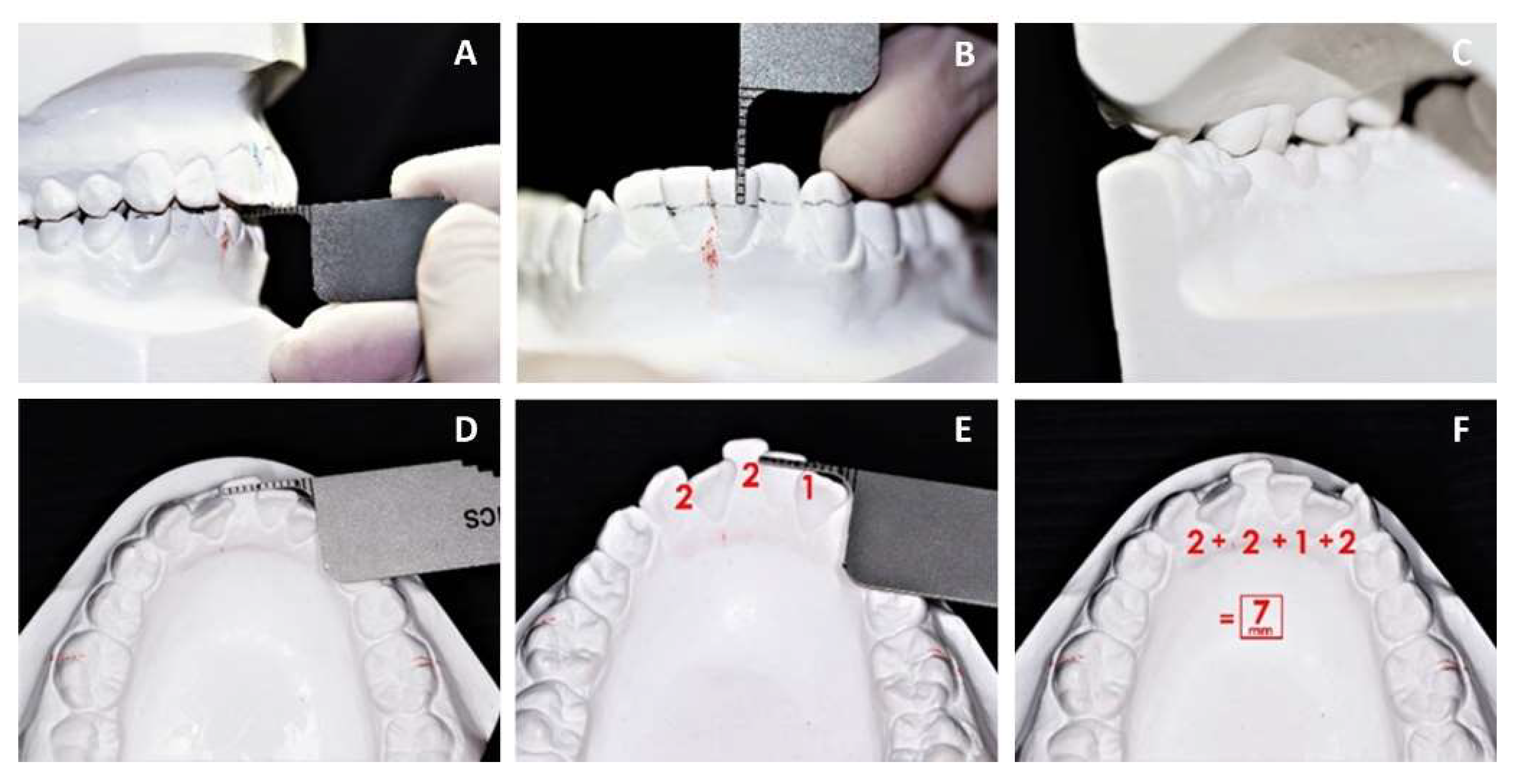 Applsci 12 06105 g003 Applsci 12 06105 g003
