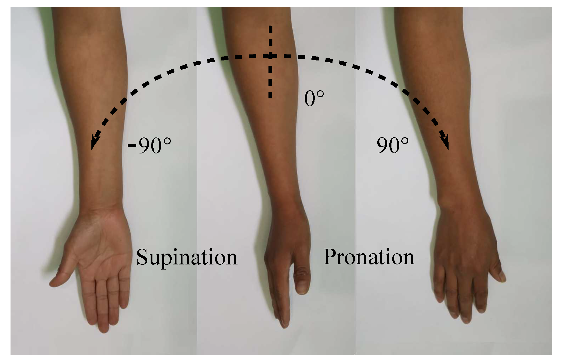 Difference Between Pronation And Supination