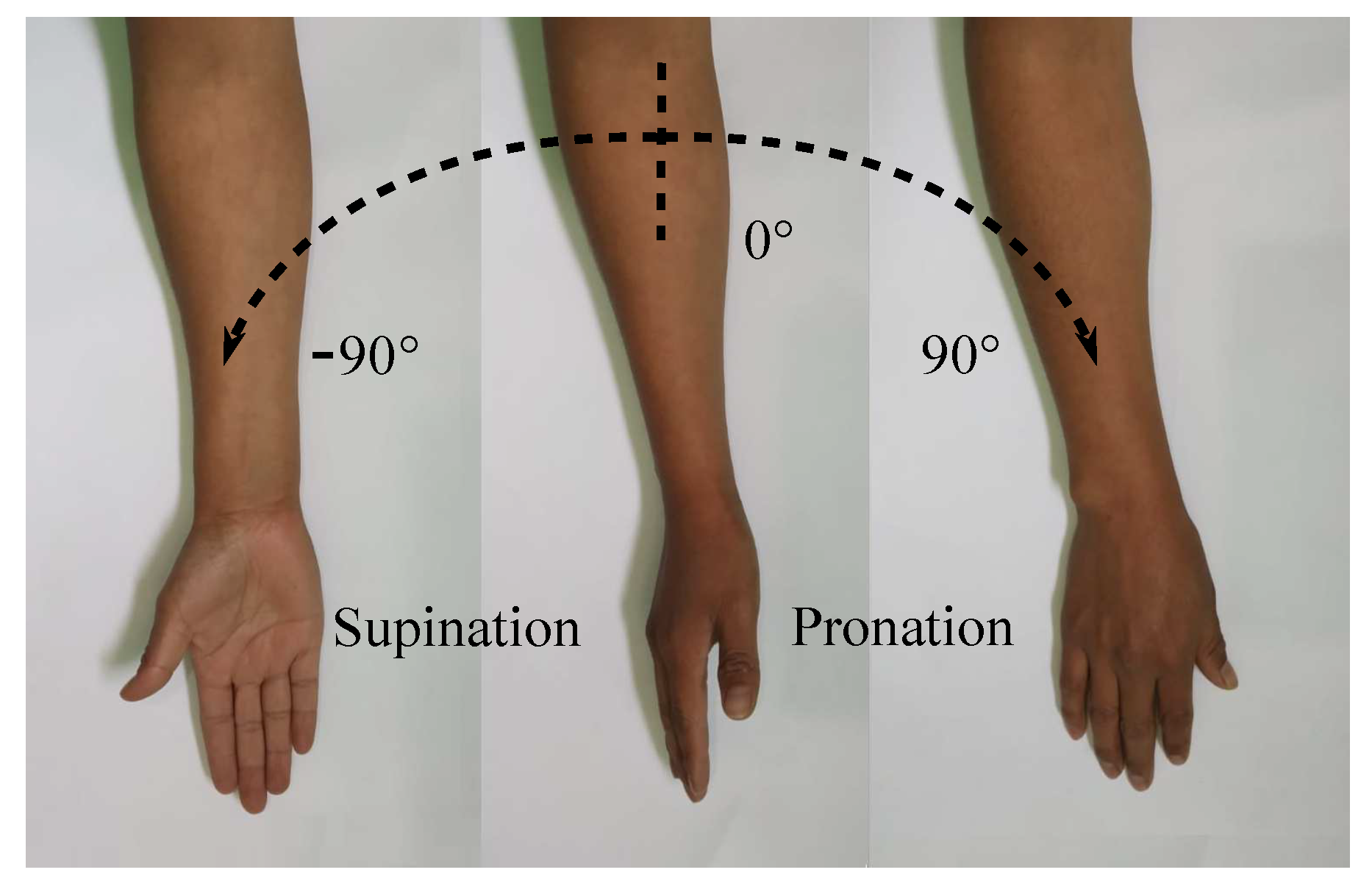 Supination and Pronation in forearm