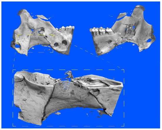 病因論と時間軸で語るBiology-Oriented Dentistry : … 病因論と時間軸で語る Biology-Oriented Dentistry