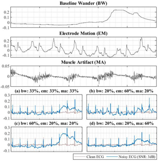 Applied Sciences | Free Full-Text | Channel-Wise Average Pooling and 1D ...