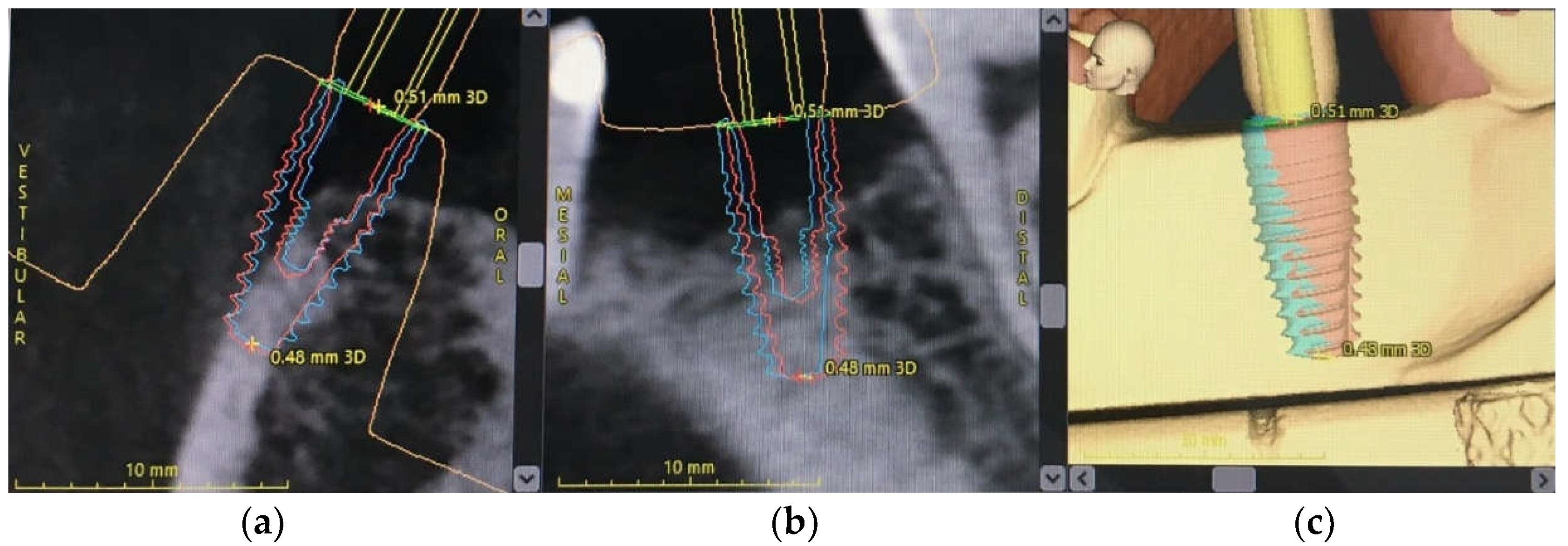 Applsci 12 07005 g005 Applsci 12 07005 g005