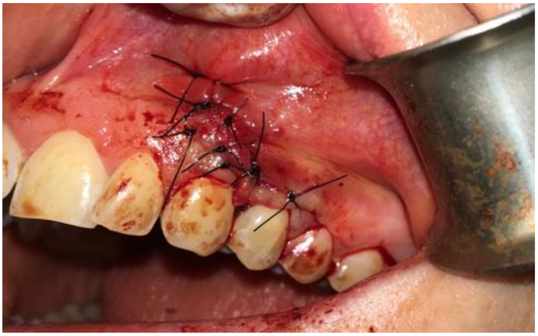 Applsci 12 07200 g005 550