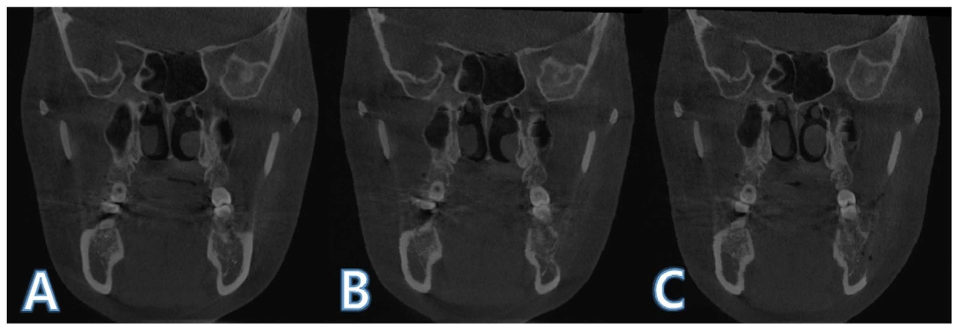 Applsci 12 07261 g005