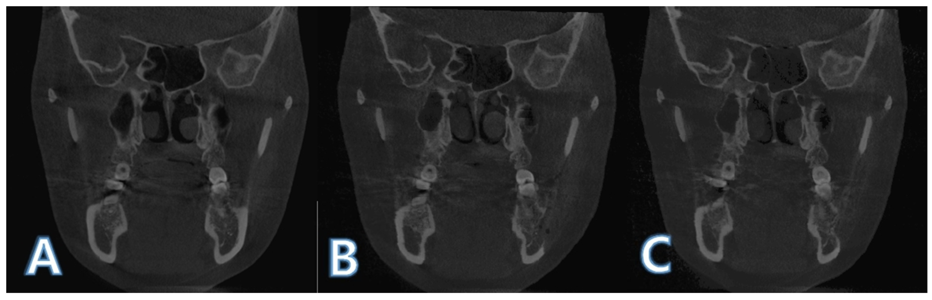 Applsci 12 07261 g006