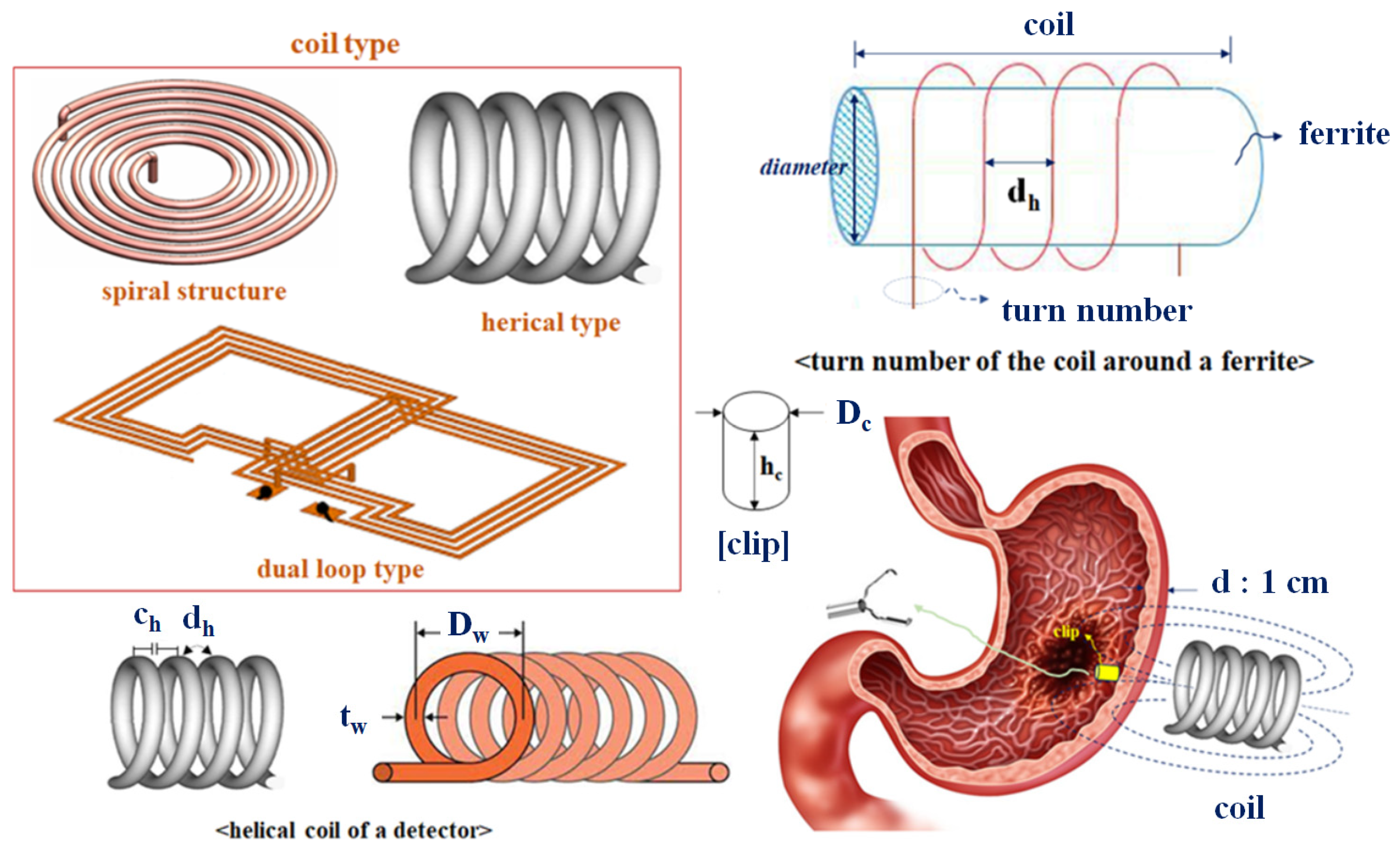 Applied Sciences | Free Full-Text | A Metal Detector for Clip Location  Tracking of Stomach and Colon Cancer during Laparoscopic Surgery | HTML