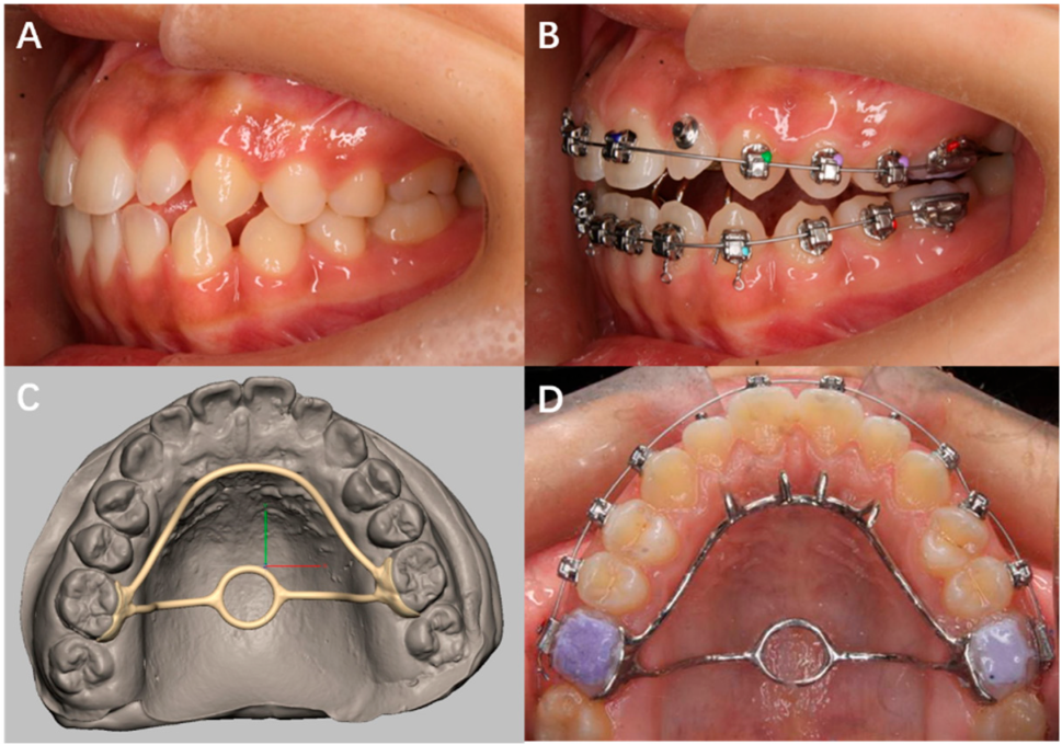 Applsci 12 07497 g007 Applsci 12 07497 g007